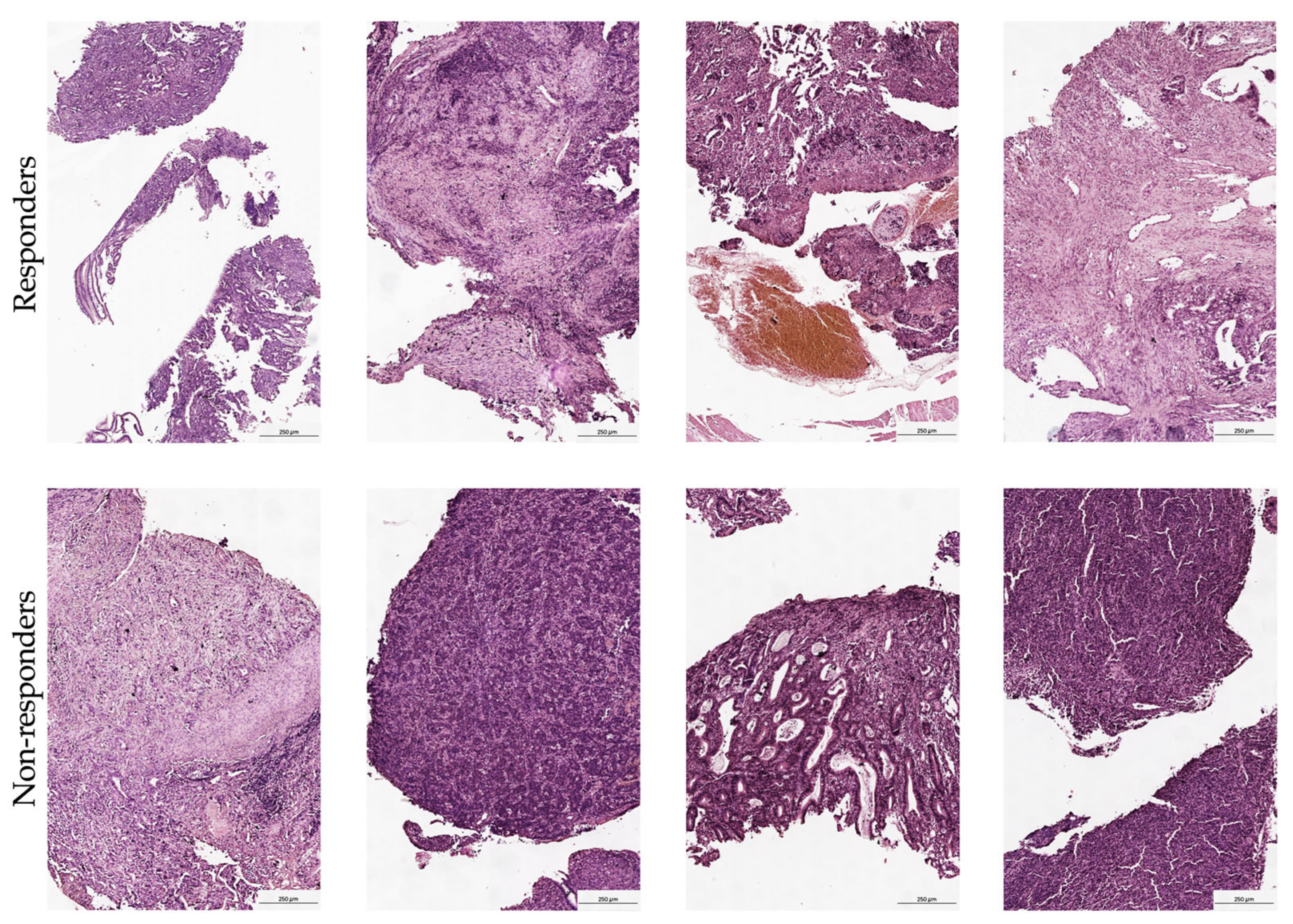 Cancers 17 02407 g002