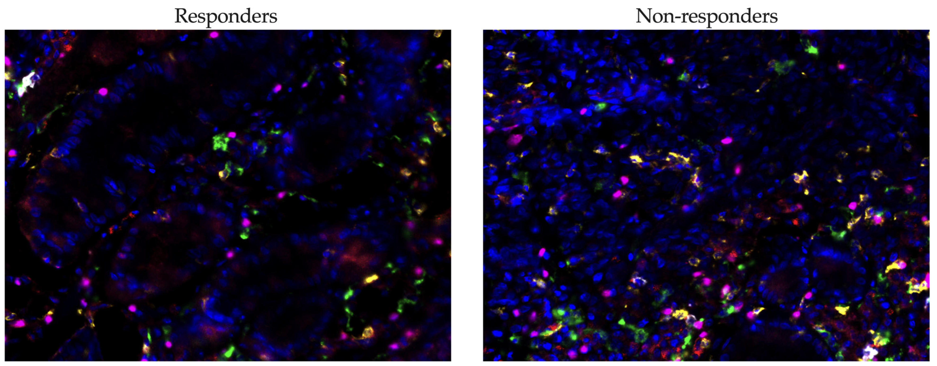 Cancers 17 02407 g003