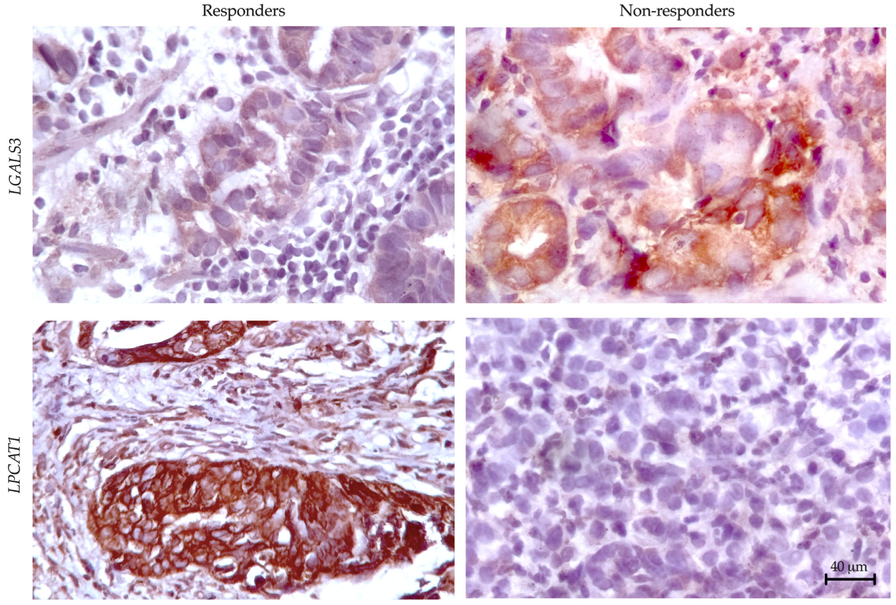 Cancers 17 02407 g005