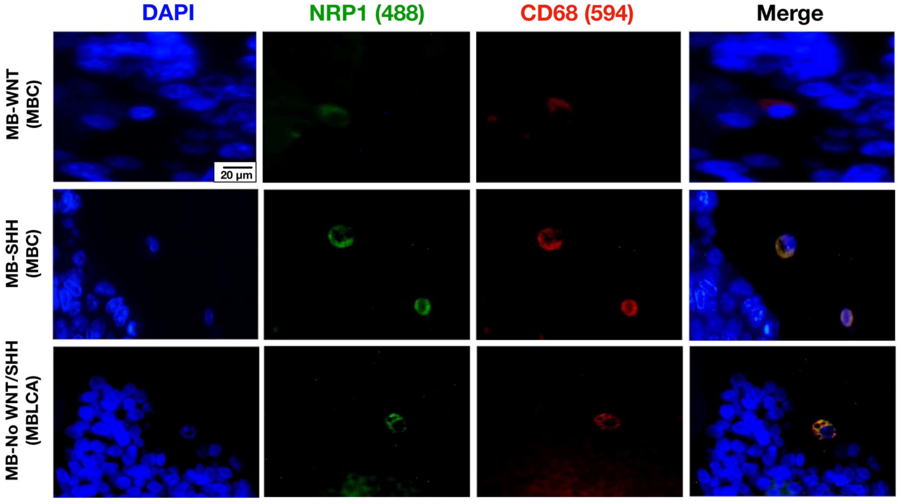 Cancers 17 02417 g002