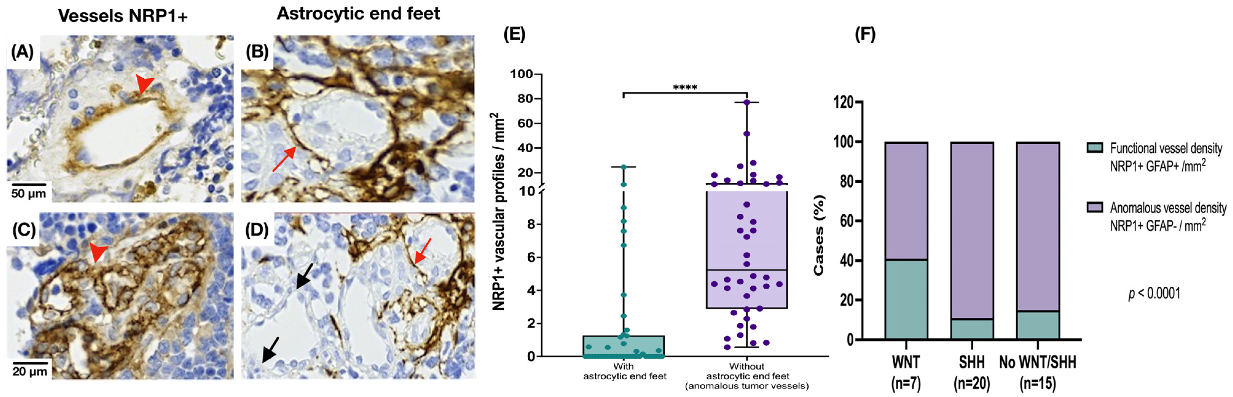 Cancers 17 02417 g004