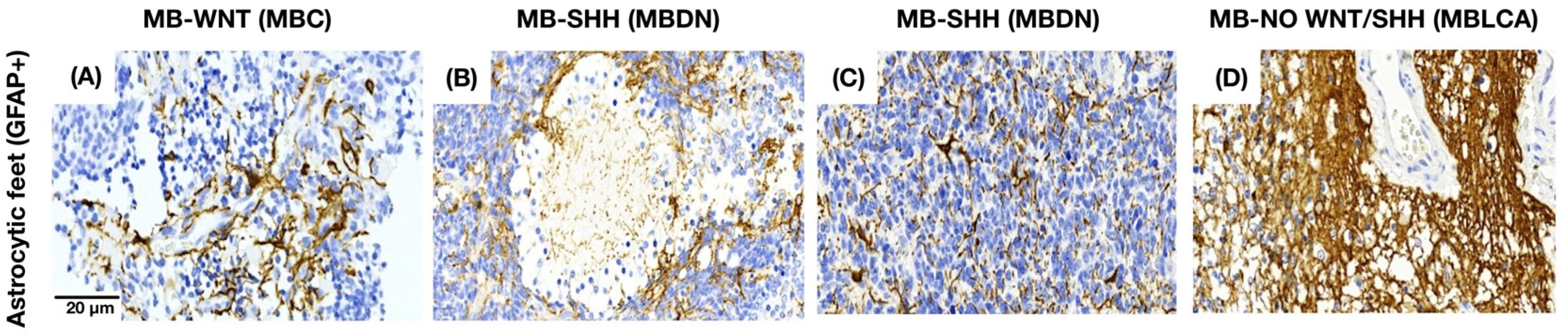 Cancers 17 02417 g005