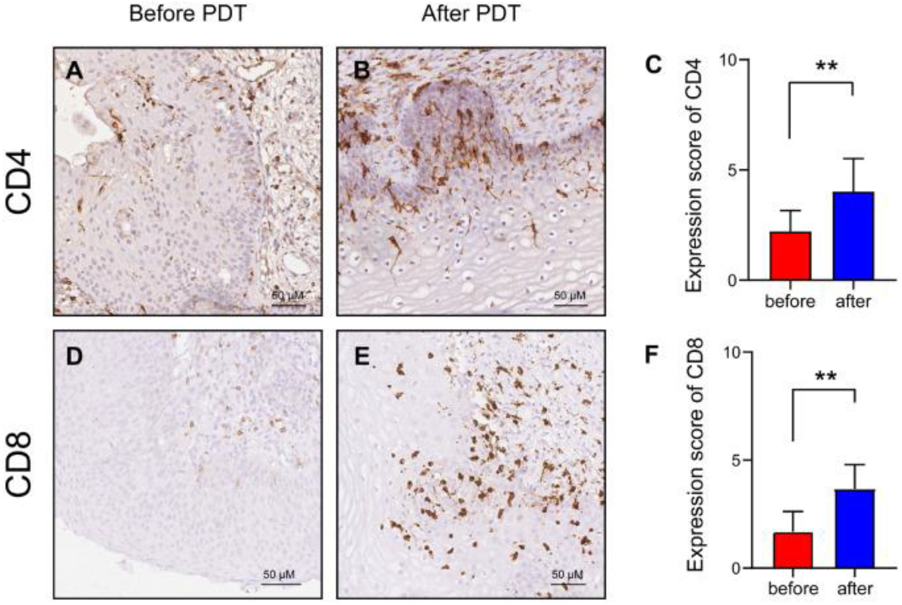 Cancers 17 02421 g003