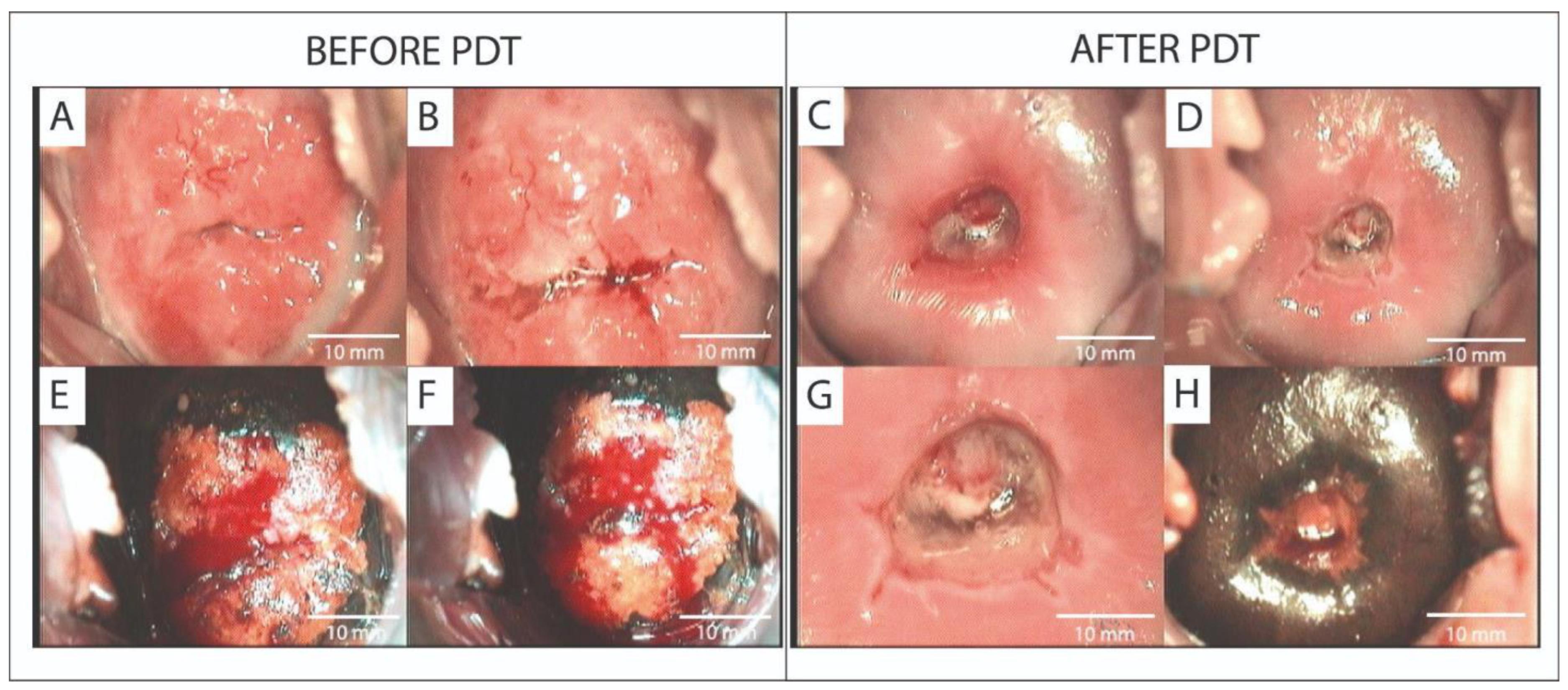 Cancers 17 02421 g005