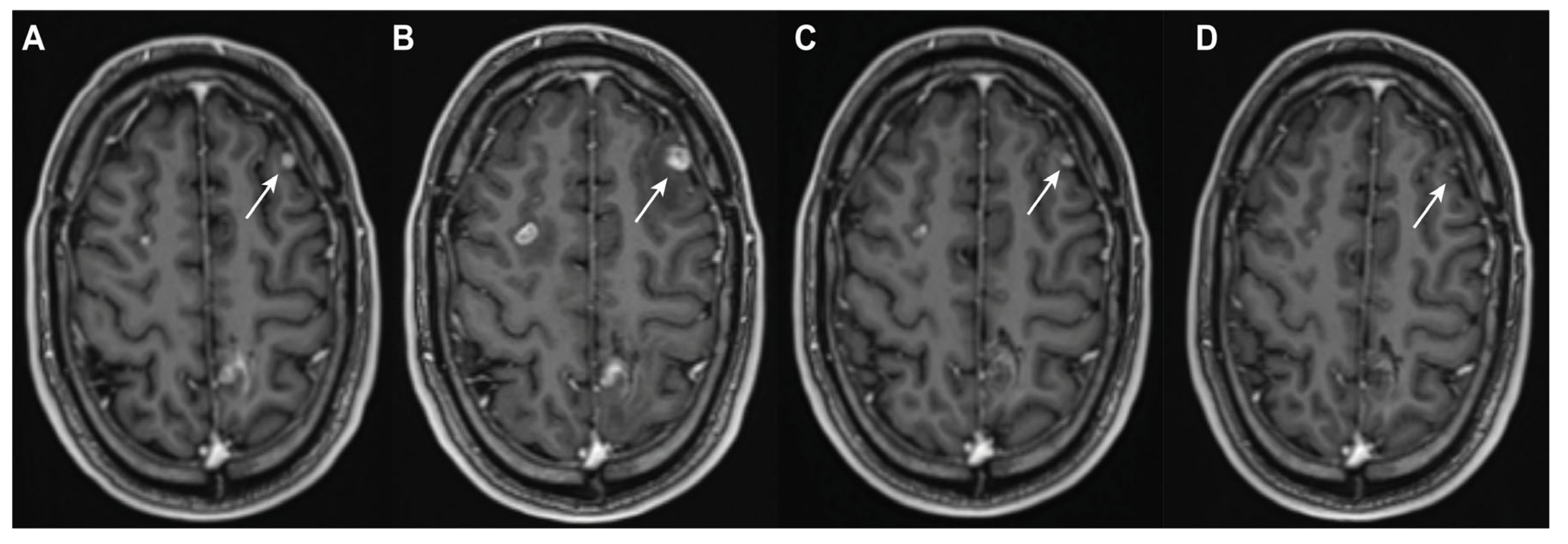 Cancers 17 02425 g001