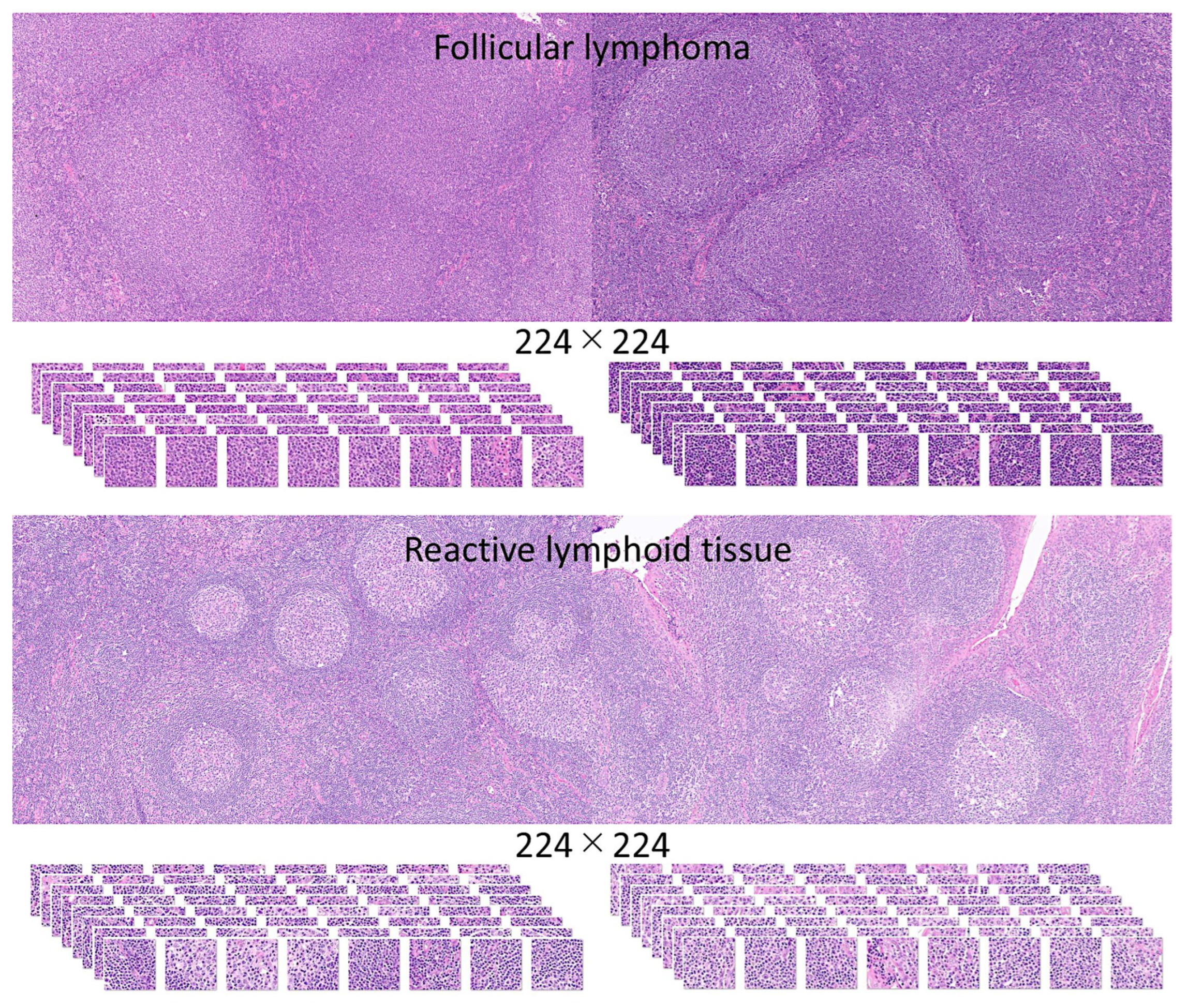 Cancers 17 02428 g005