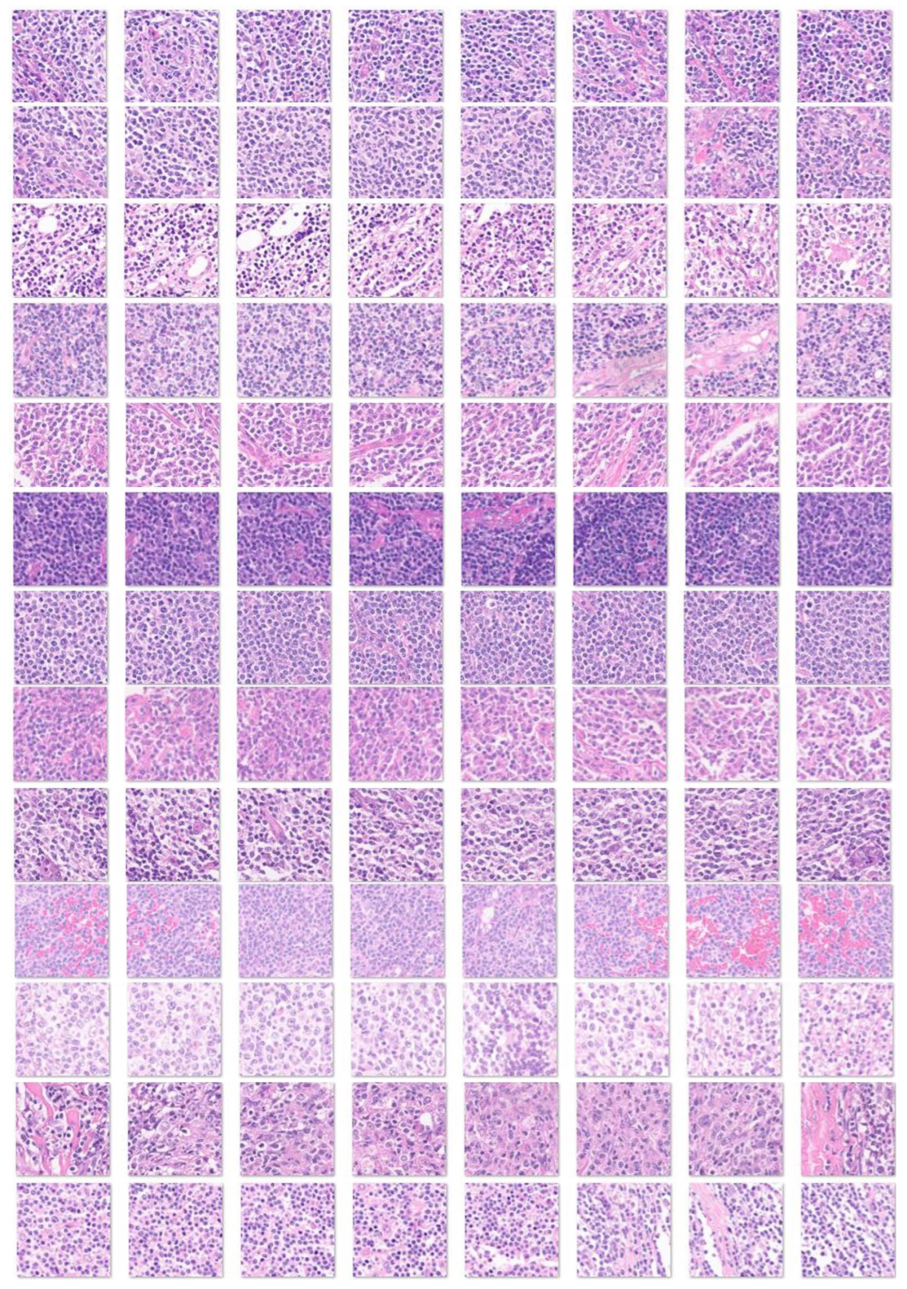 Cancers 17 02428 g006