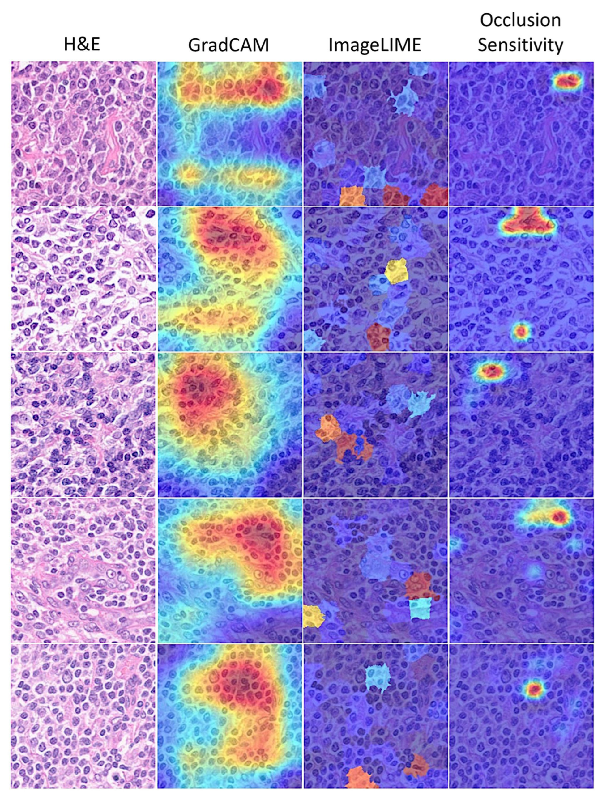 Cancers 17 02428 g012