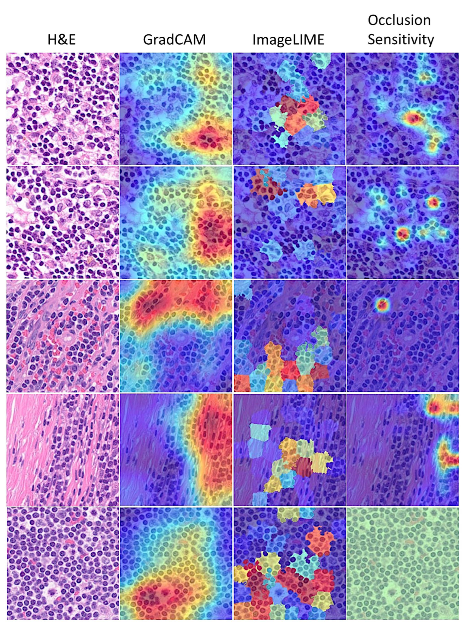 Cancers 17 02428 g013