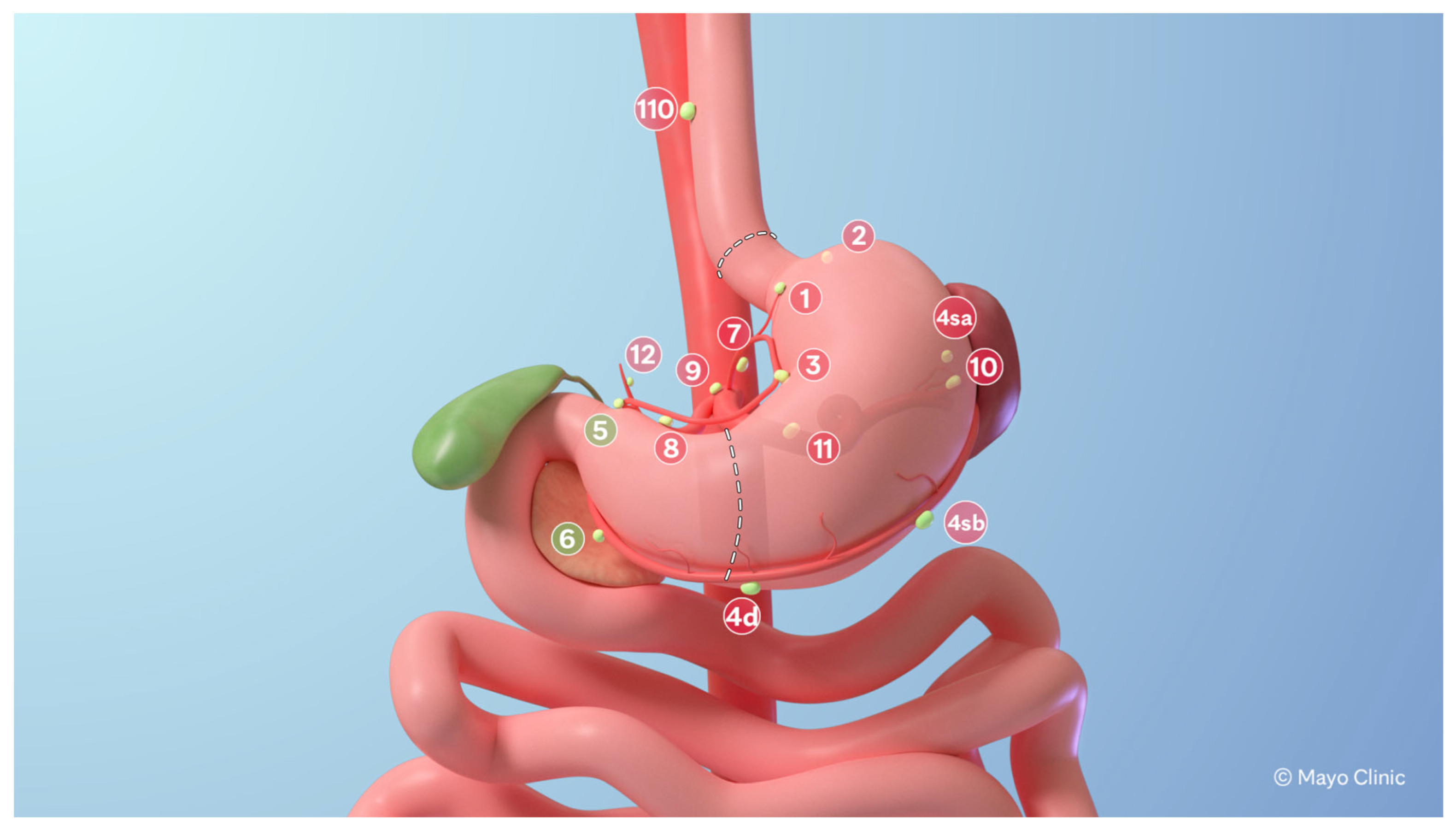 Cancers 17 02455 g001