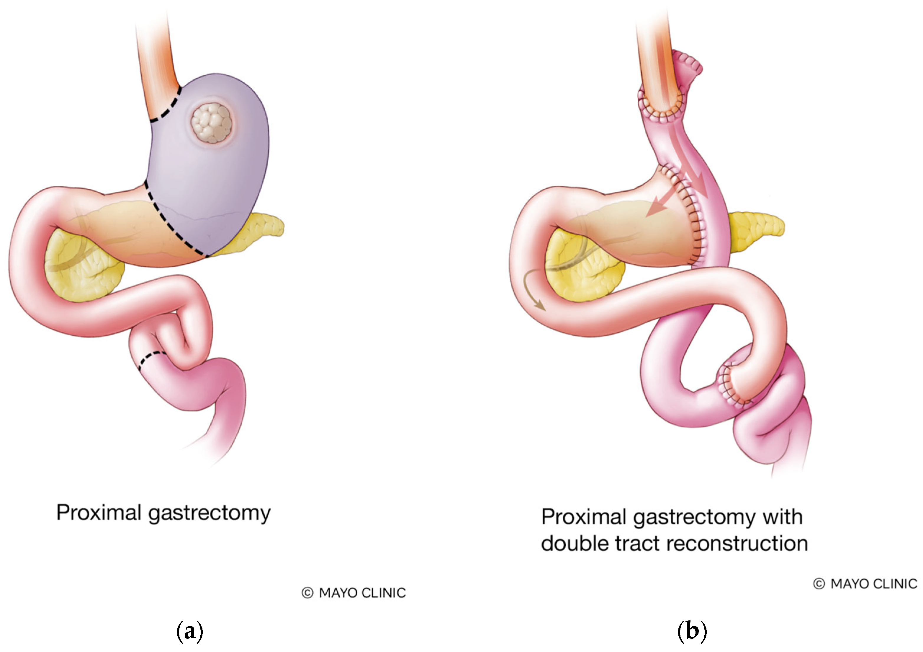 Cancers 17 02455 g002