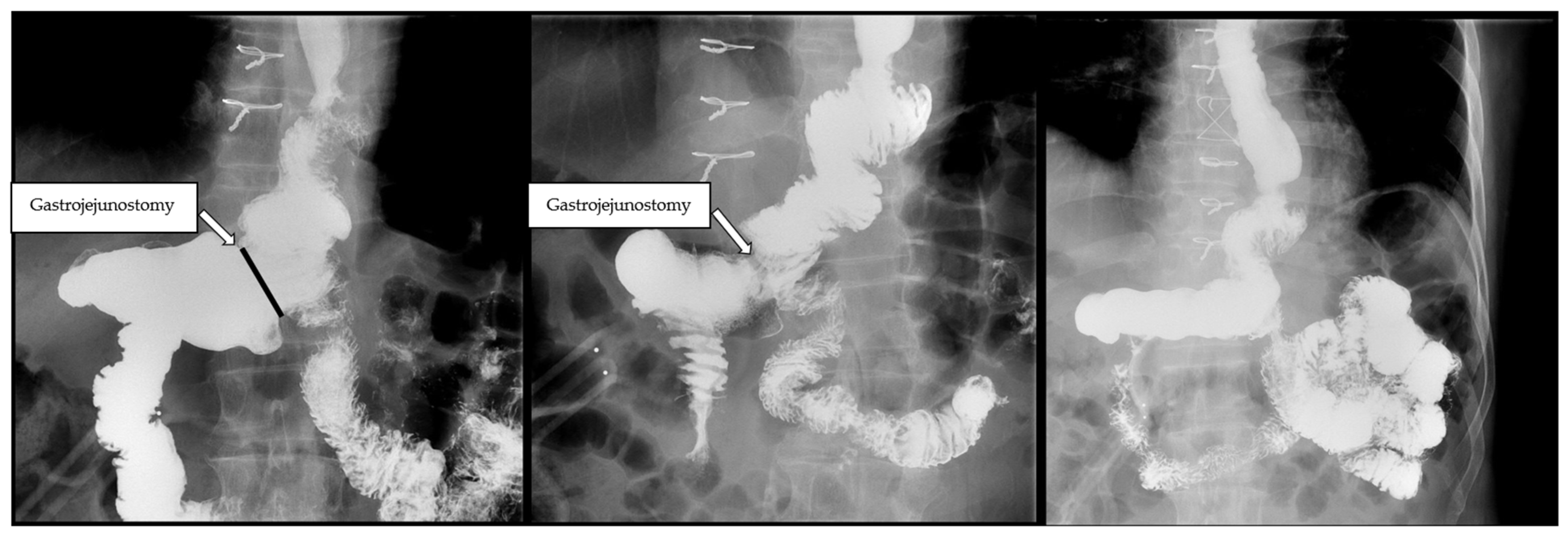 Cancers 17 02455 g003