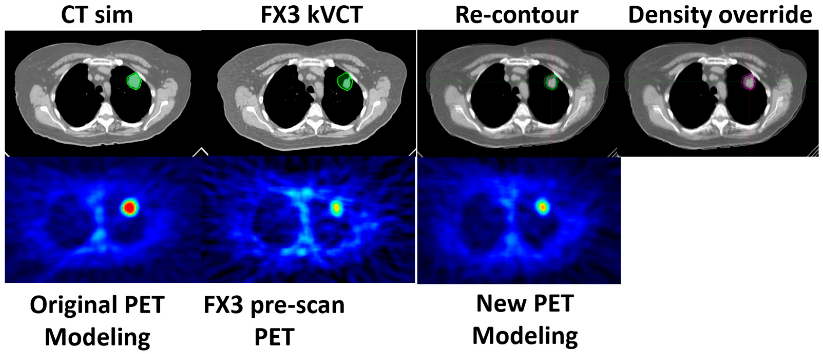 Cancers 17 02470 g005