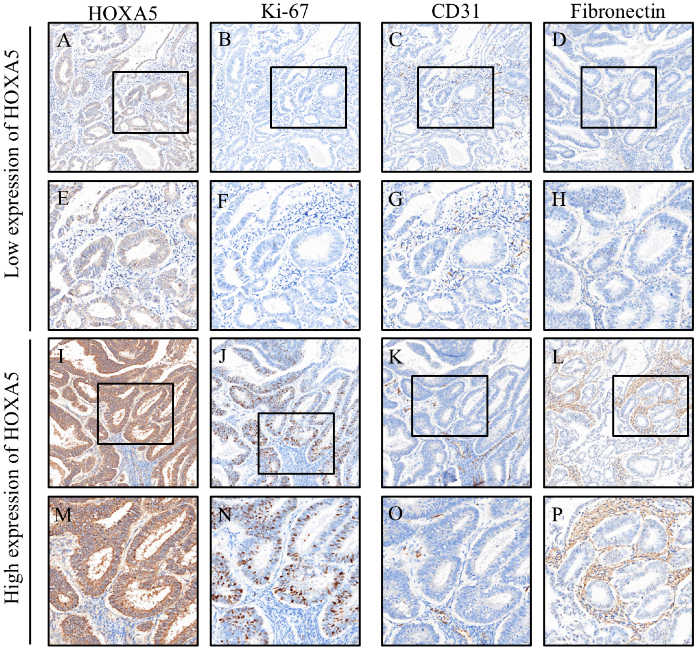 Cancers 17 02473 g002