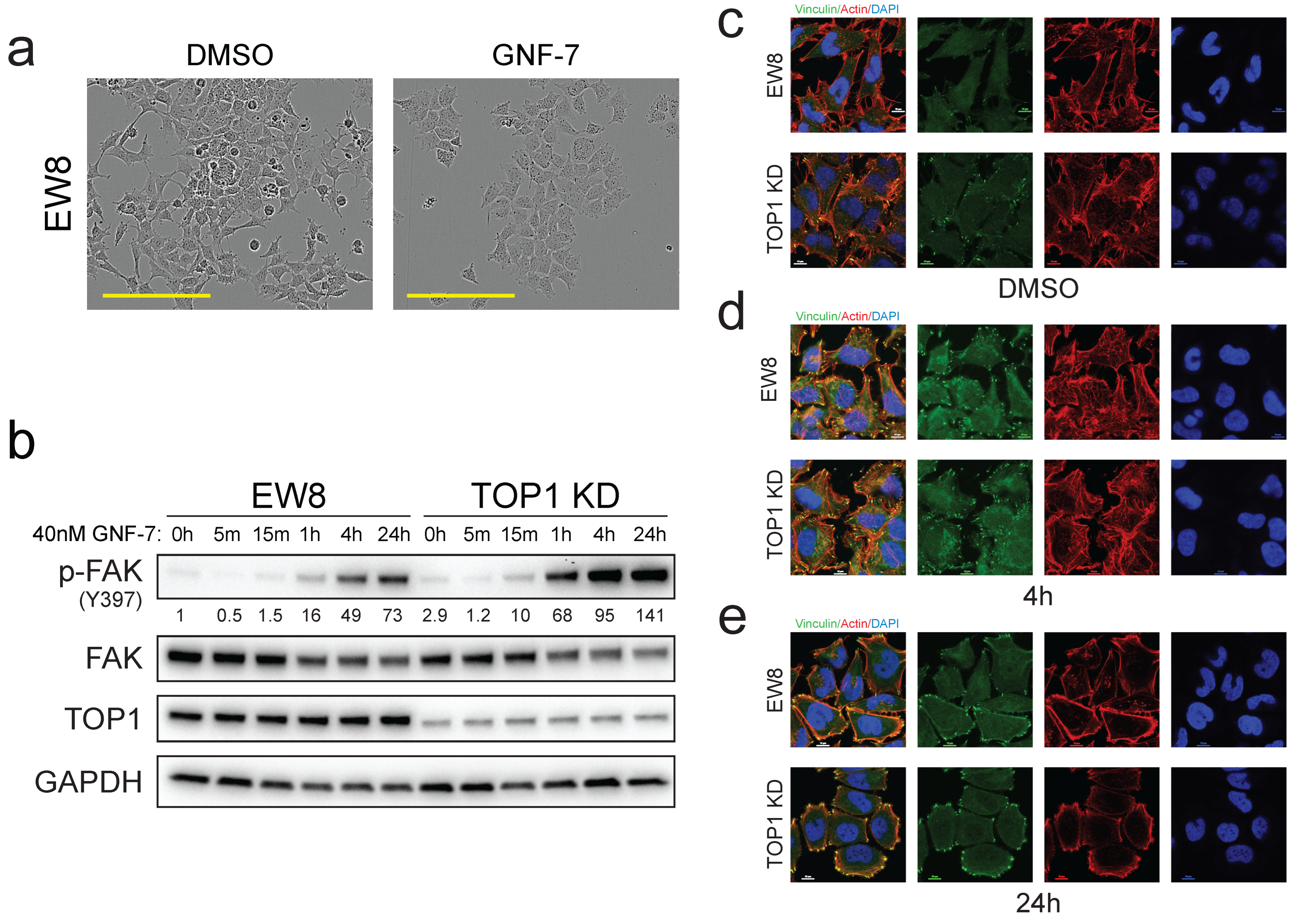 Cancers 17 02475 g005