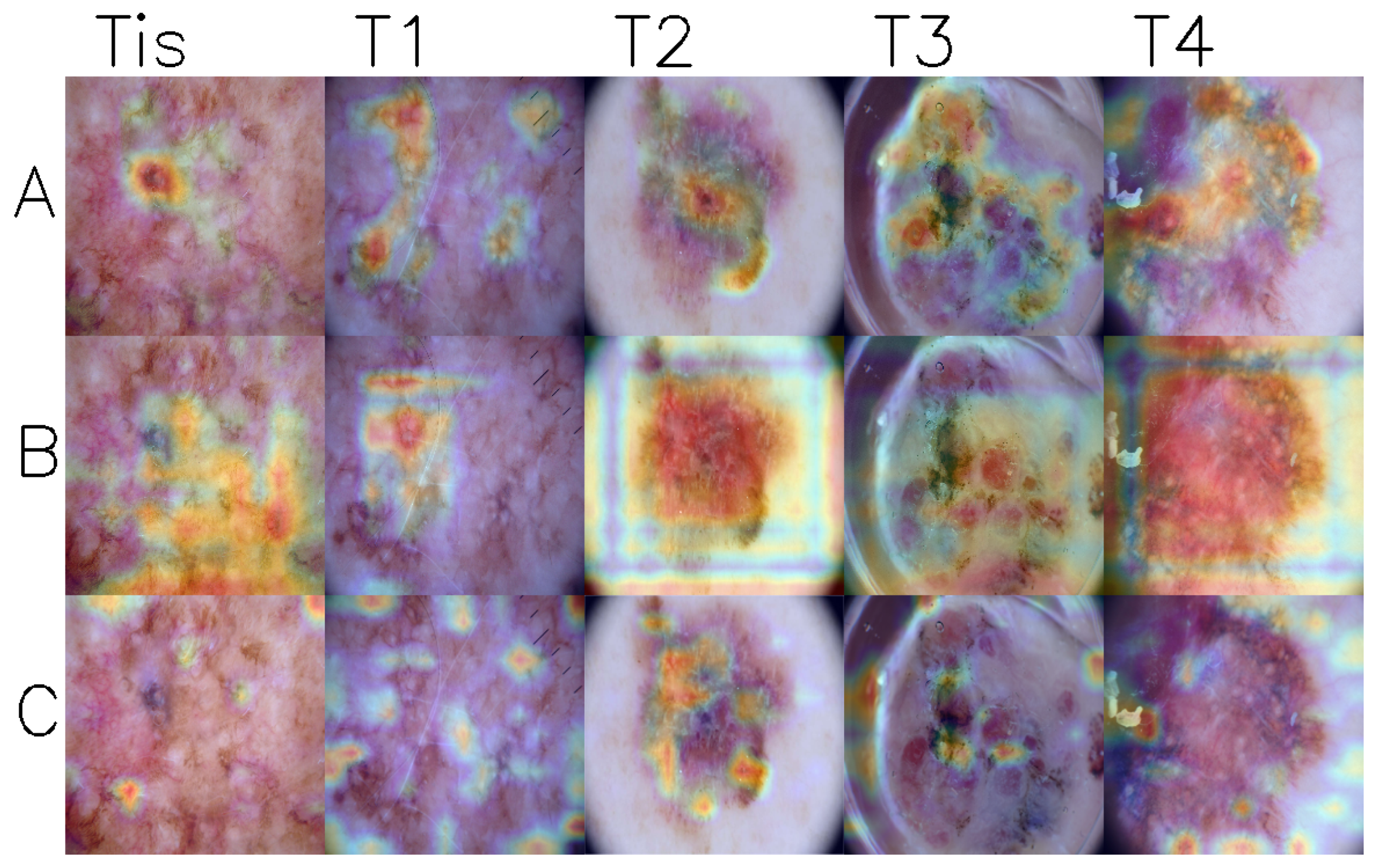 Cancers 17 02476 g003