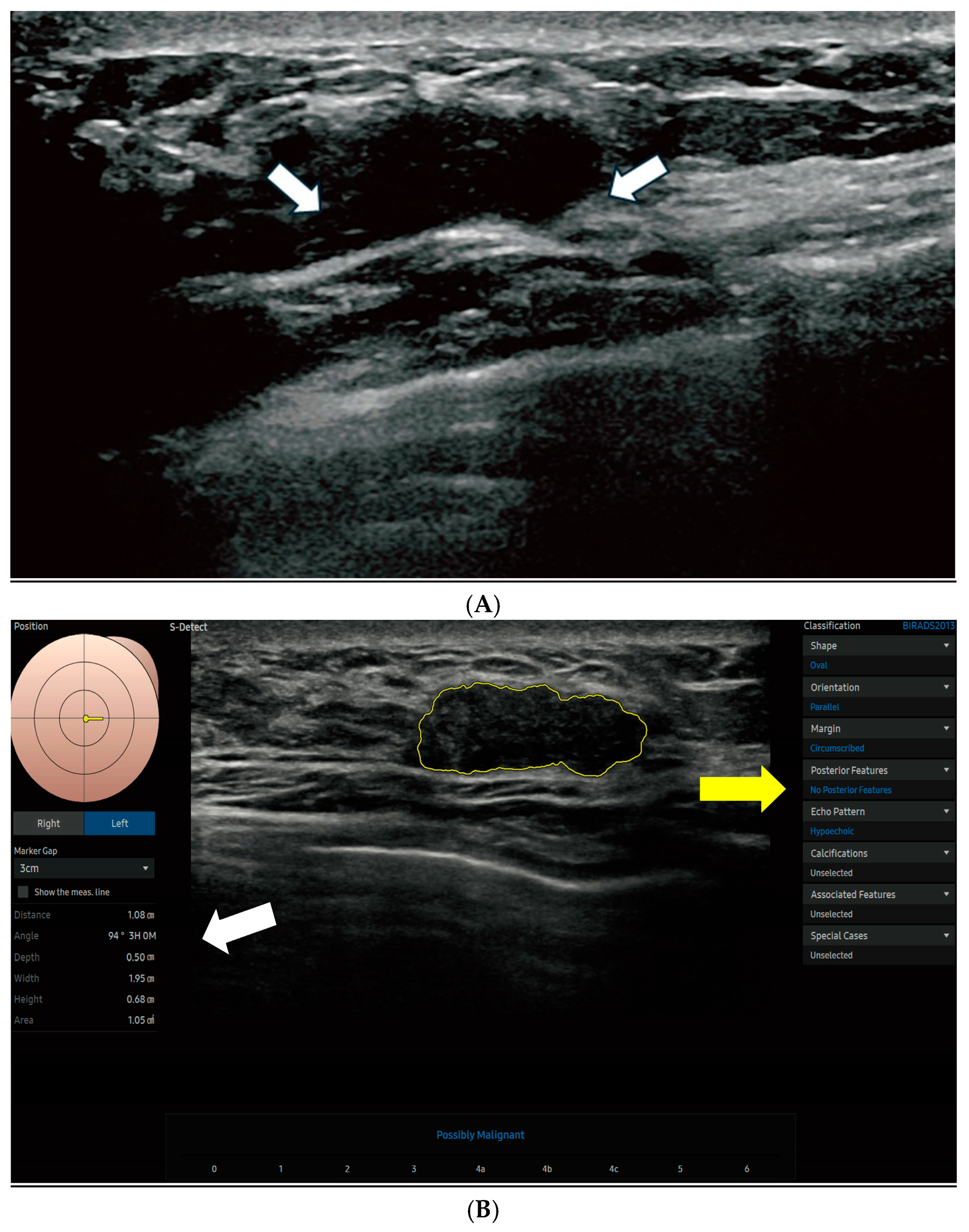 Cancers 17 02497 g002