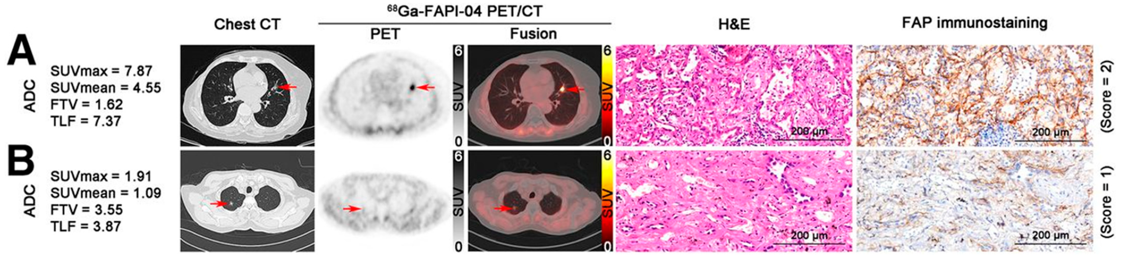 Cancers 17 02549 g007