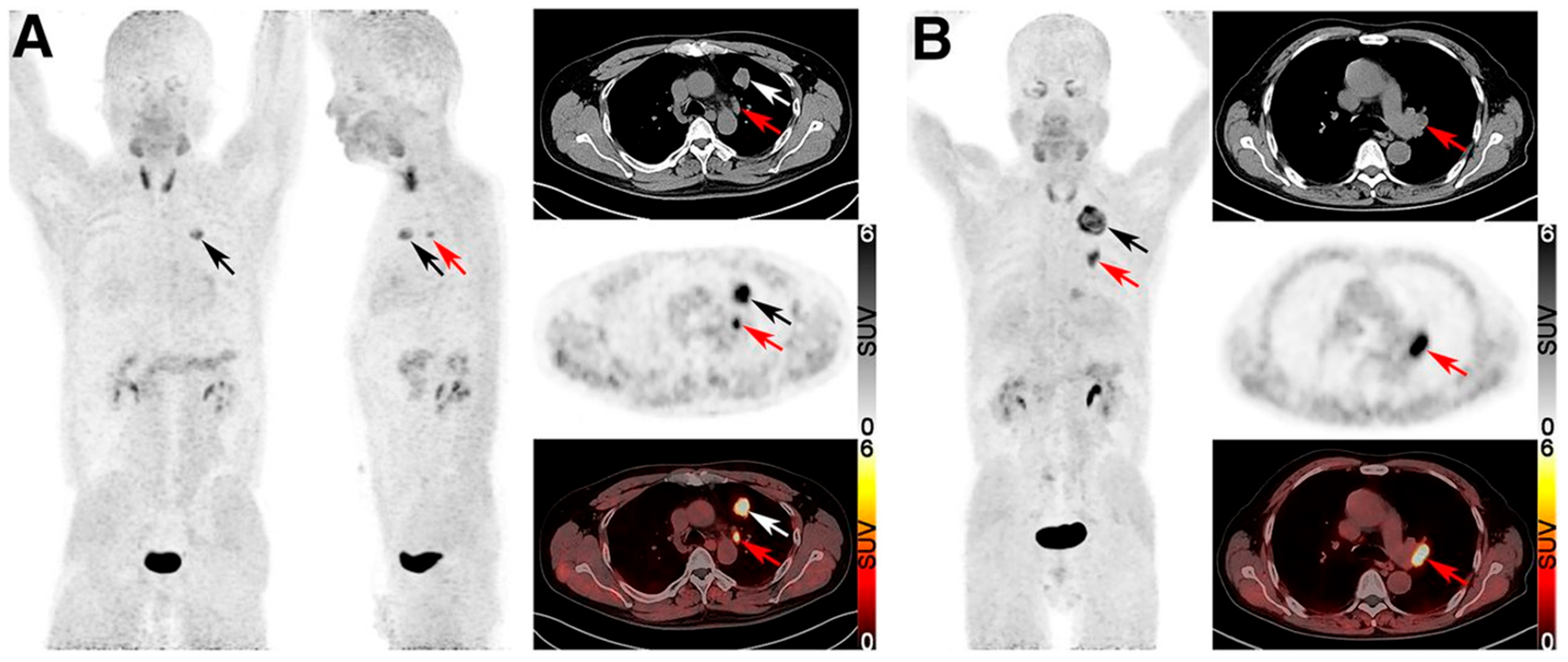 Cancers 17 02549 g008