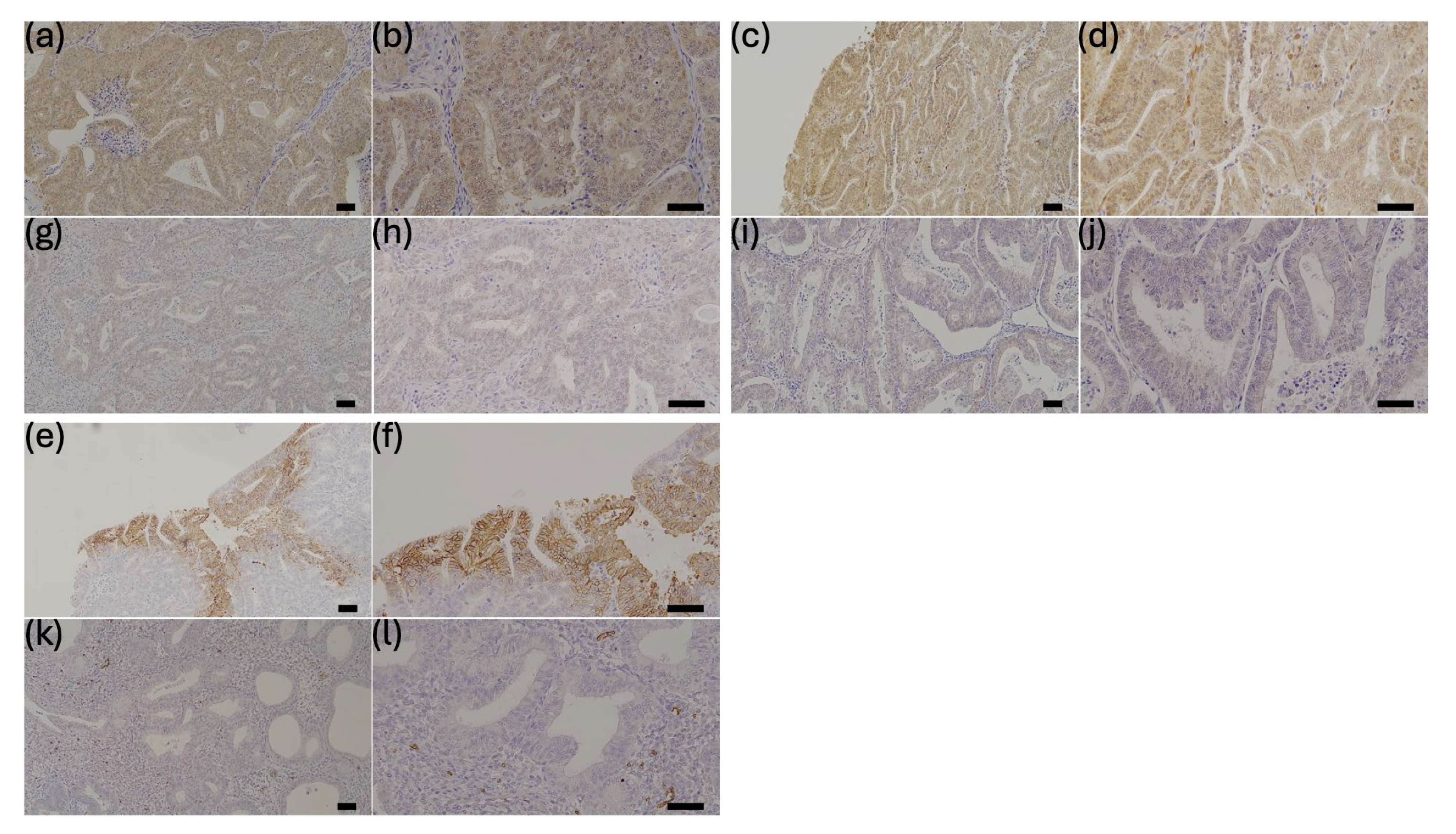 Cancers 17 02554 g001