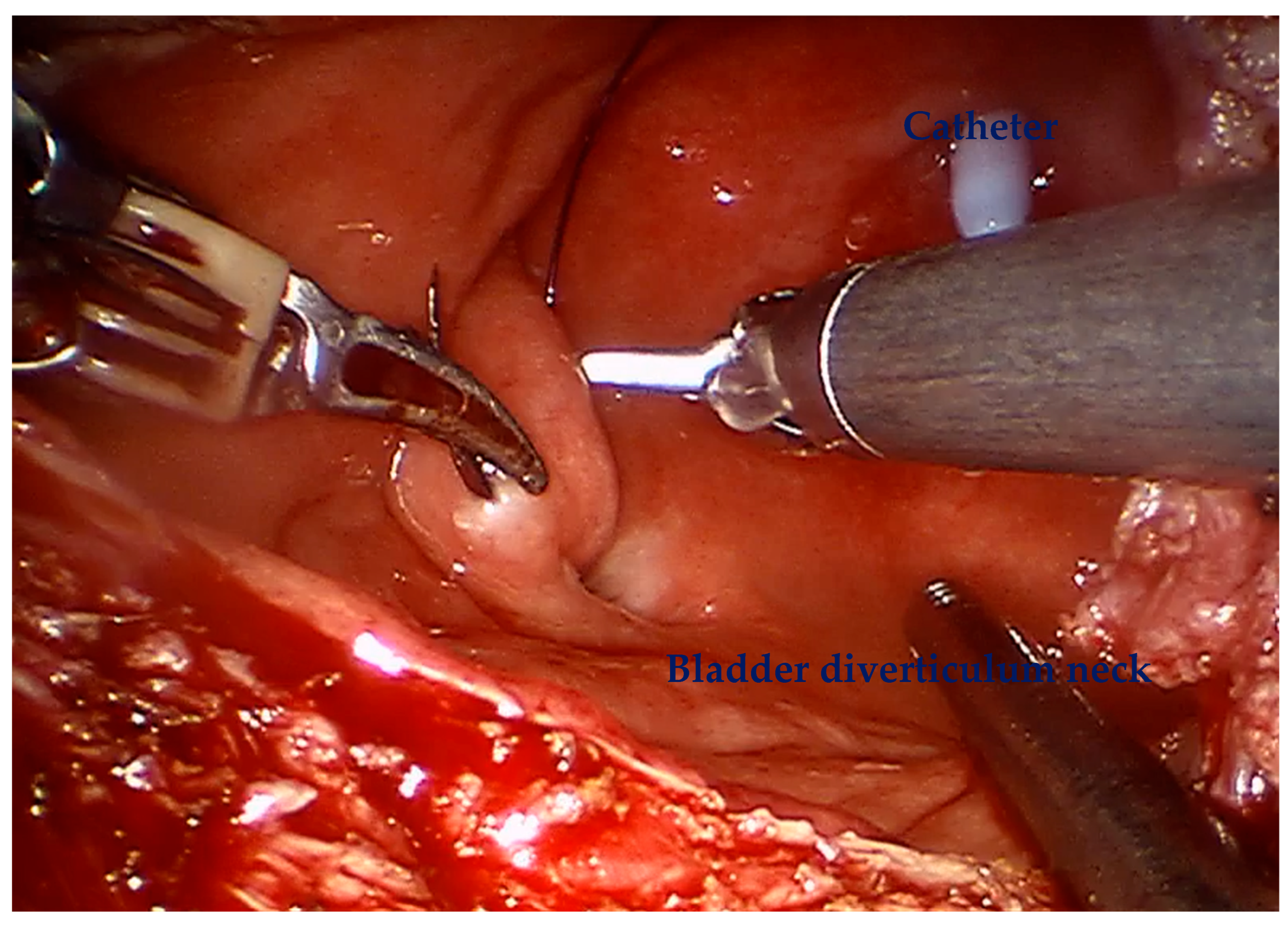 Cancers 17 02562 g003