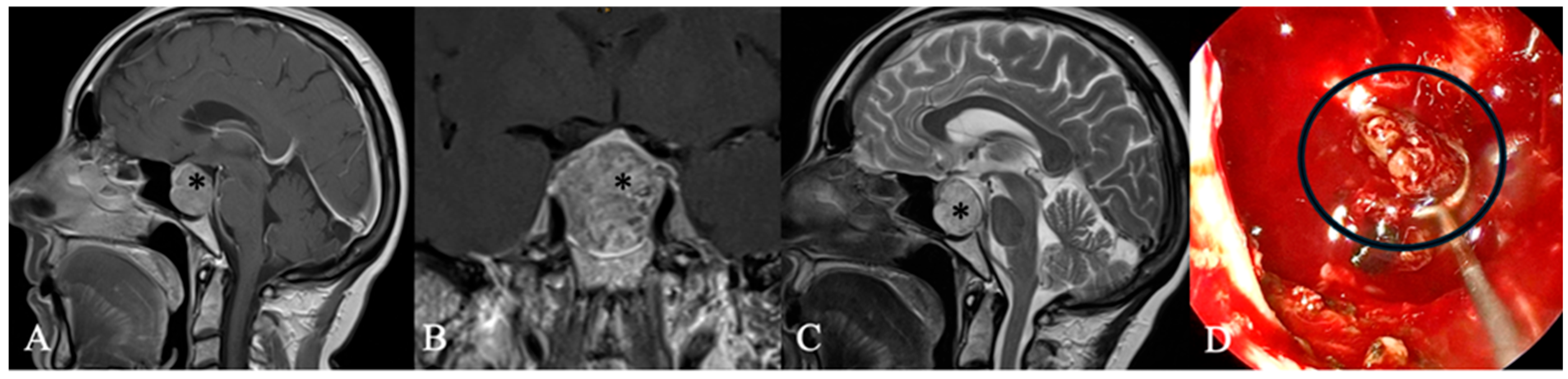 Cancers 17 02568 g004