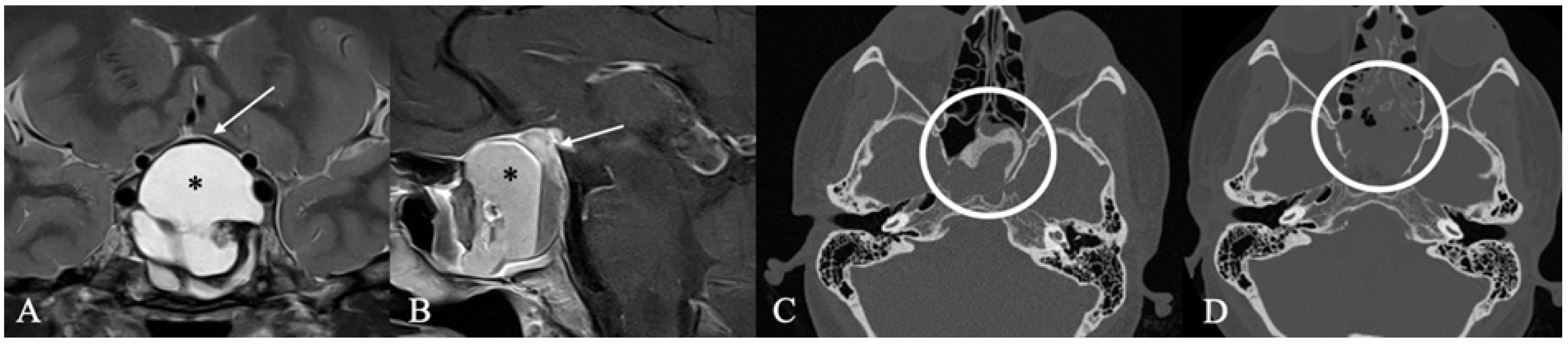 Cancers 17 02568 g005