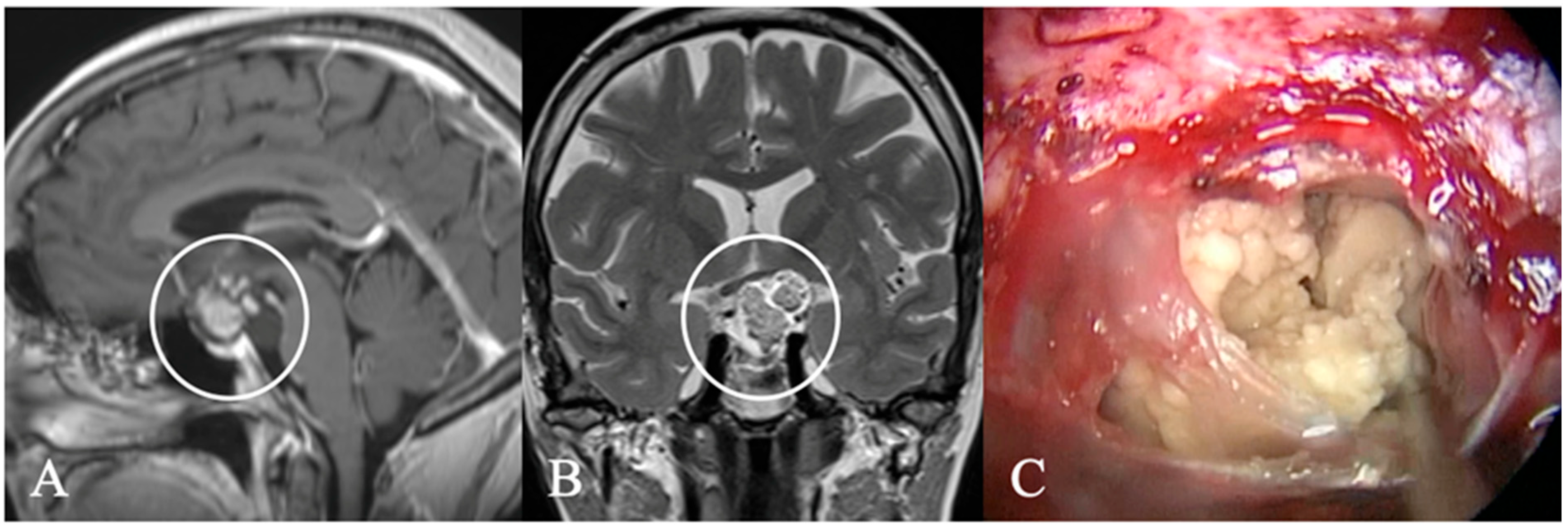 Cancers 17 02568 g006