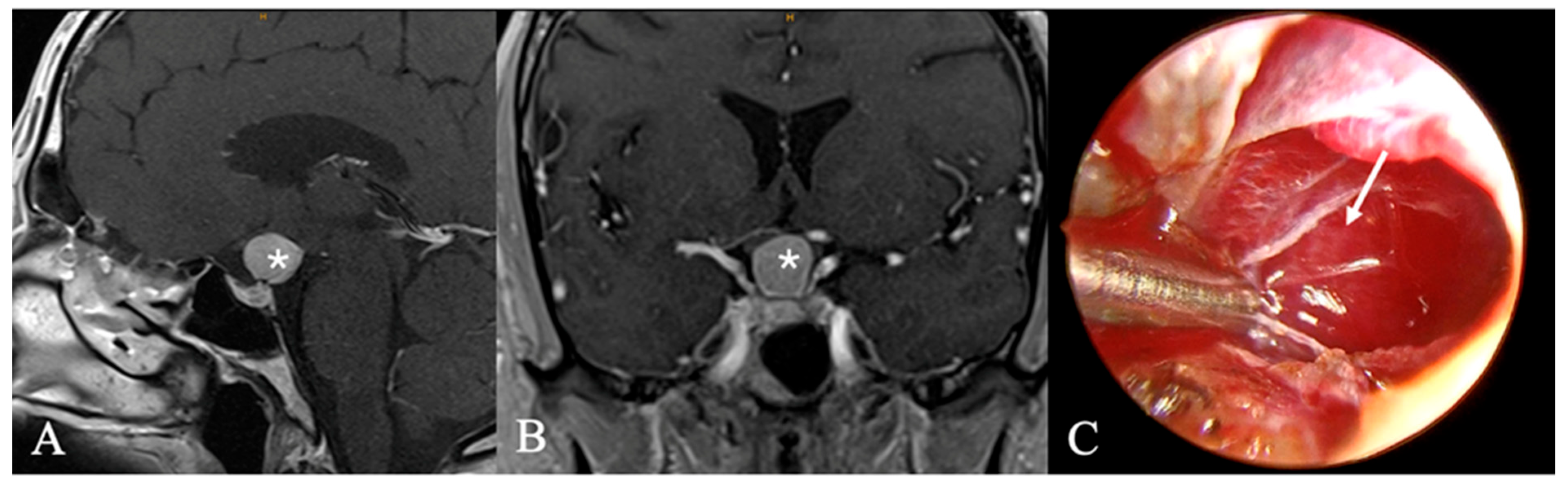 Cancers 17 02568 g007