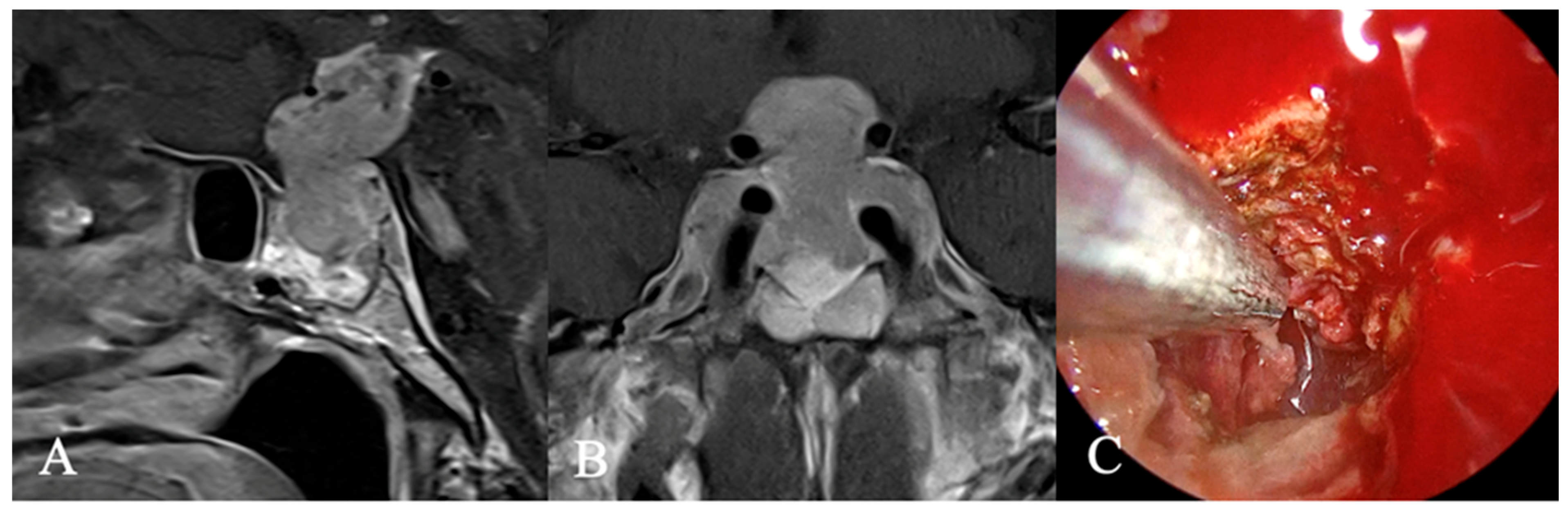 Cancers 17 02568 g008