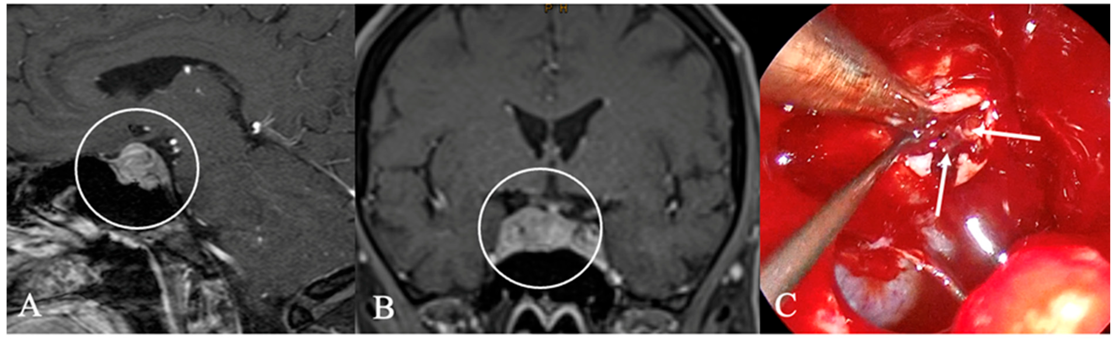 Cancers 17 02568 g009