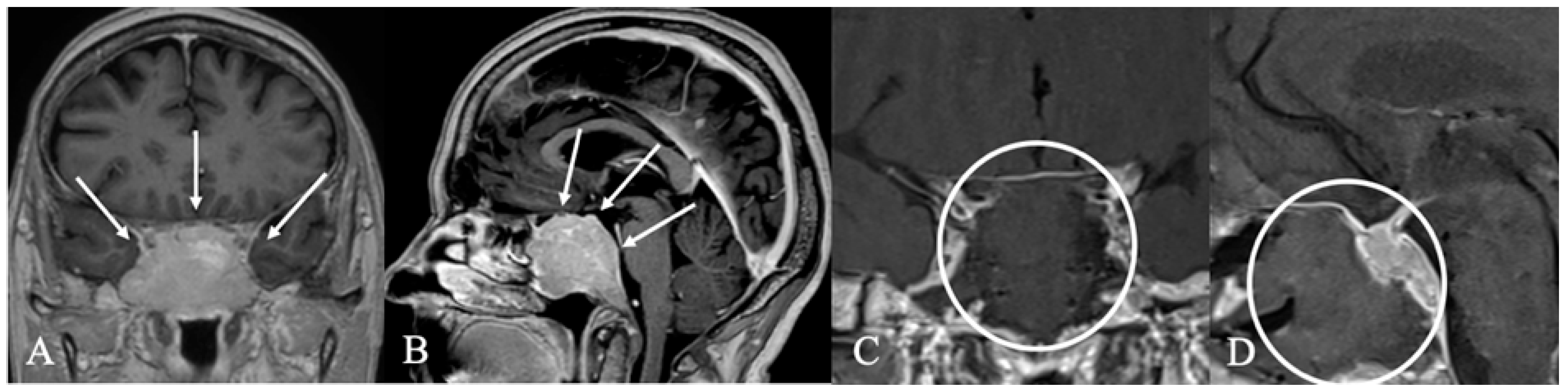 Cancers 17 02568 g010