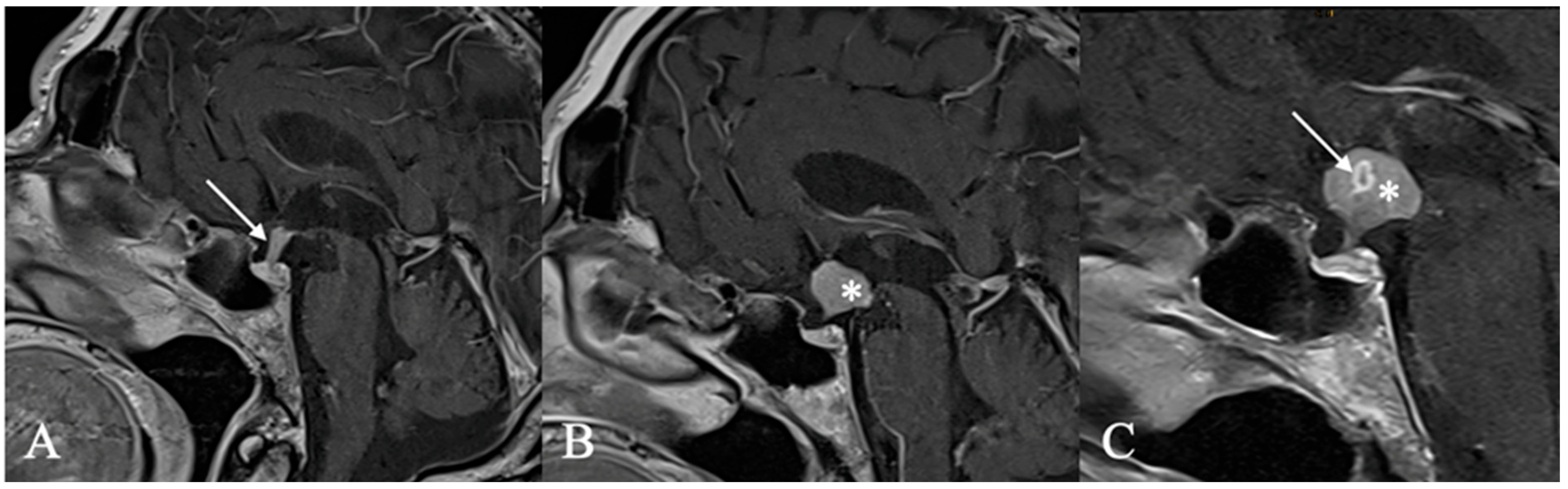 Cancers 17 02568 g011