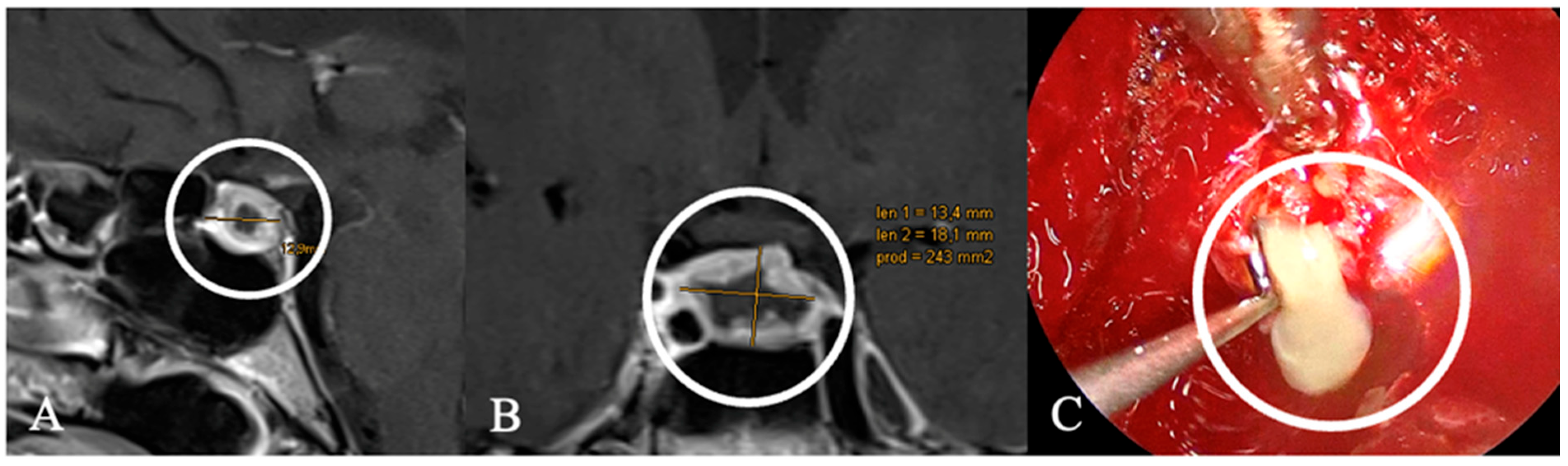 Cancers 17 02568 g014