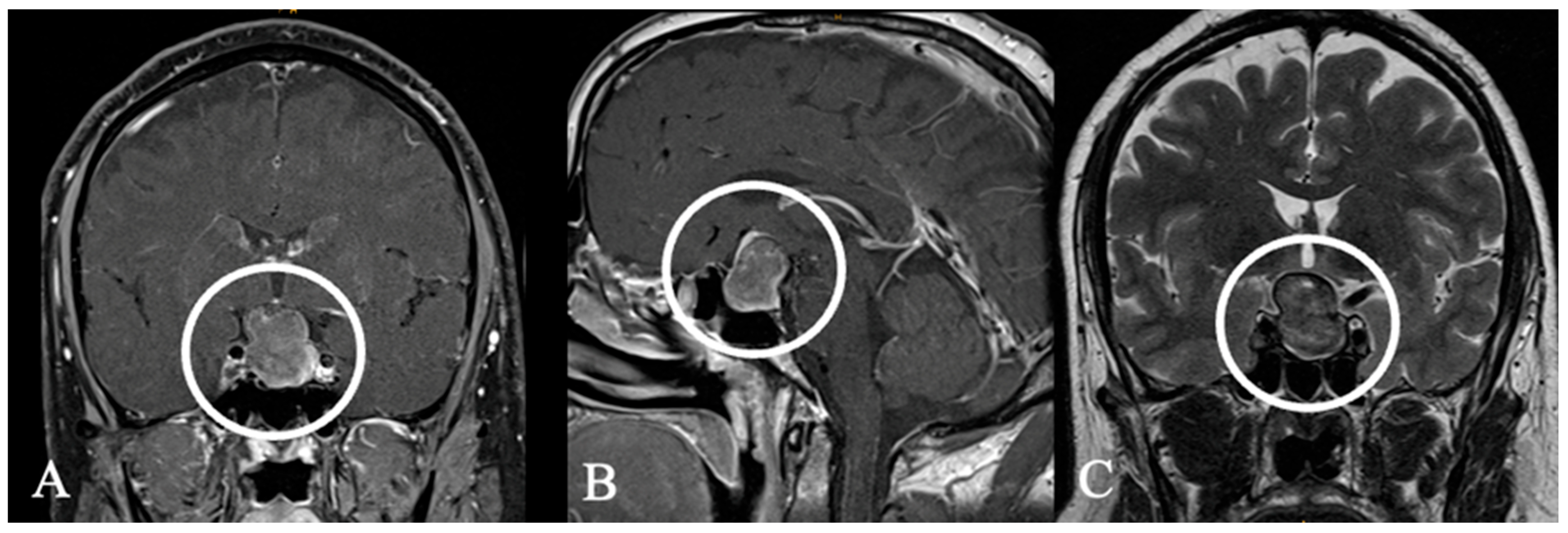 Cancers 17 02568 g015