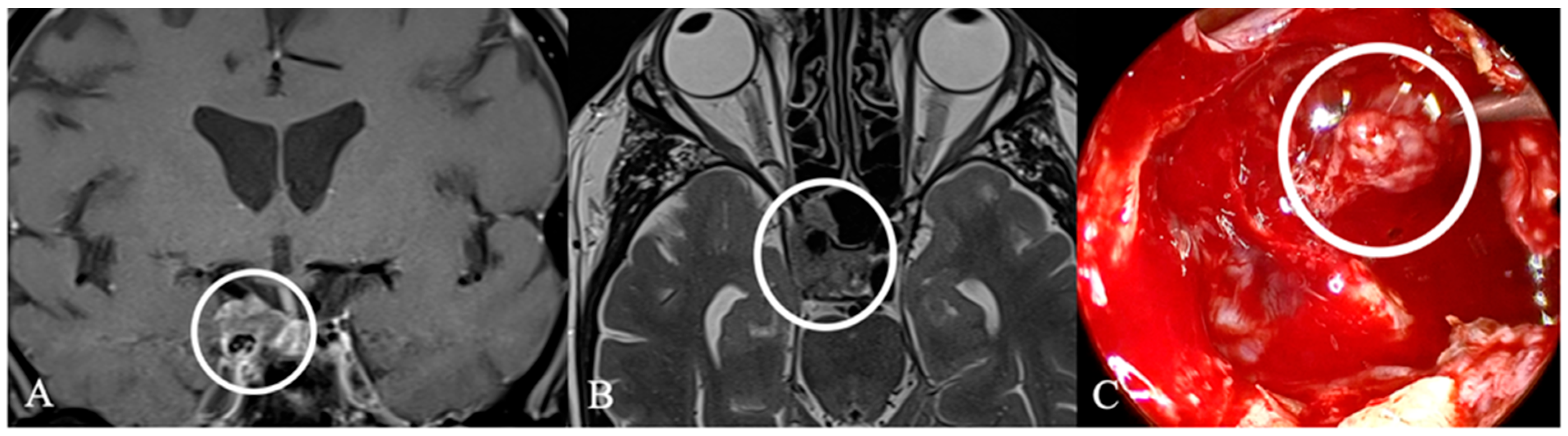 Cancers 17 02568 g017