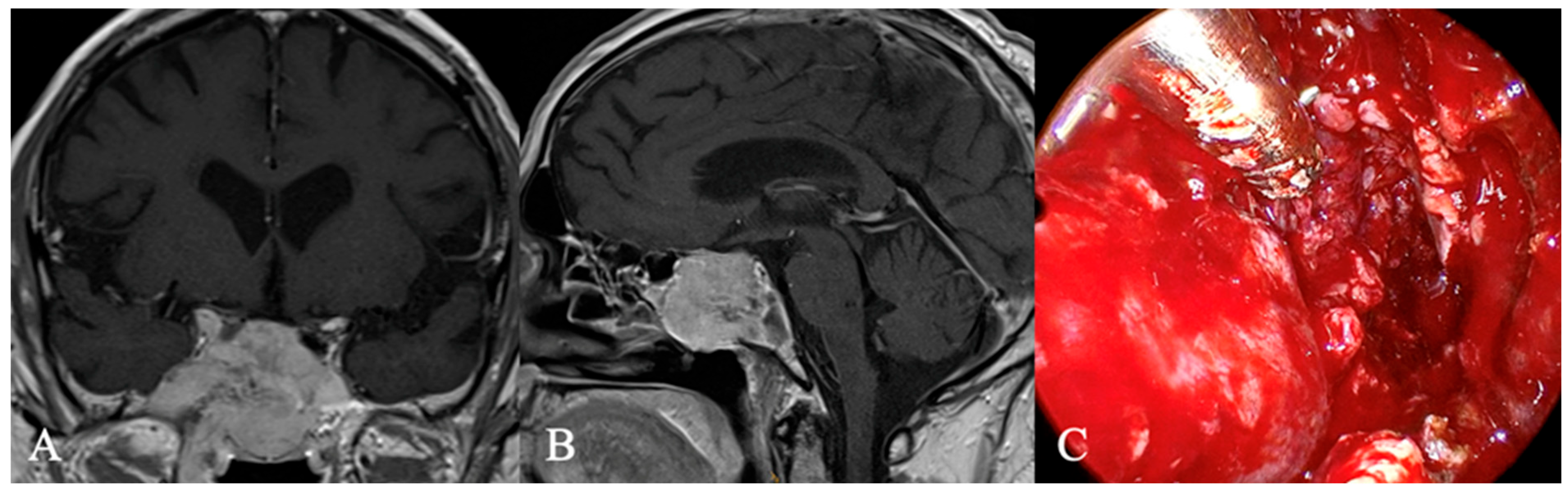 Cancers 17 02568 g018