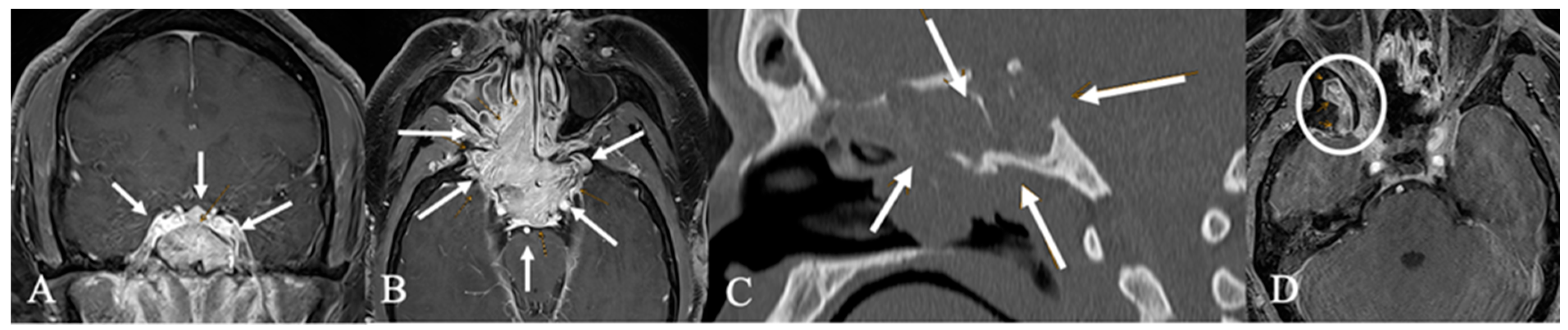 Cancers 17 02568 g019