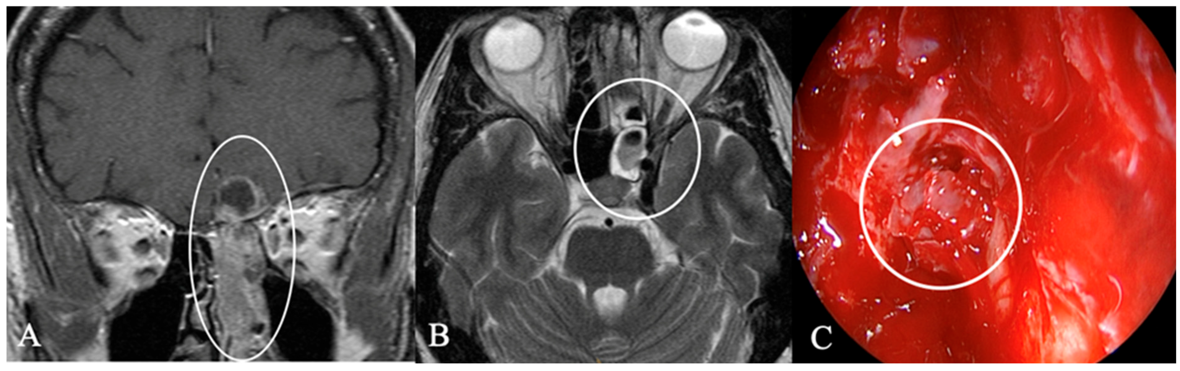 Cancers 17 02568 g020