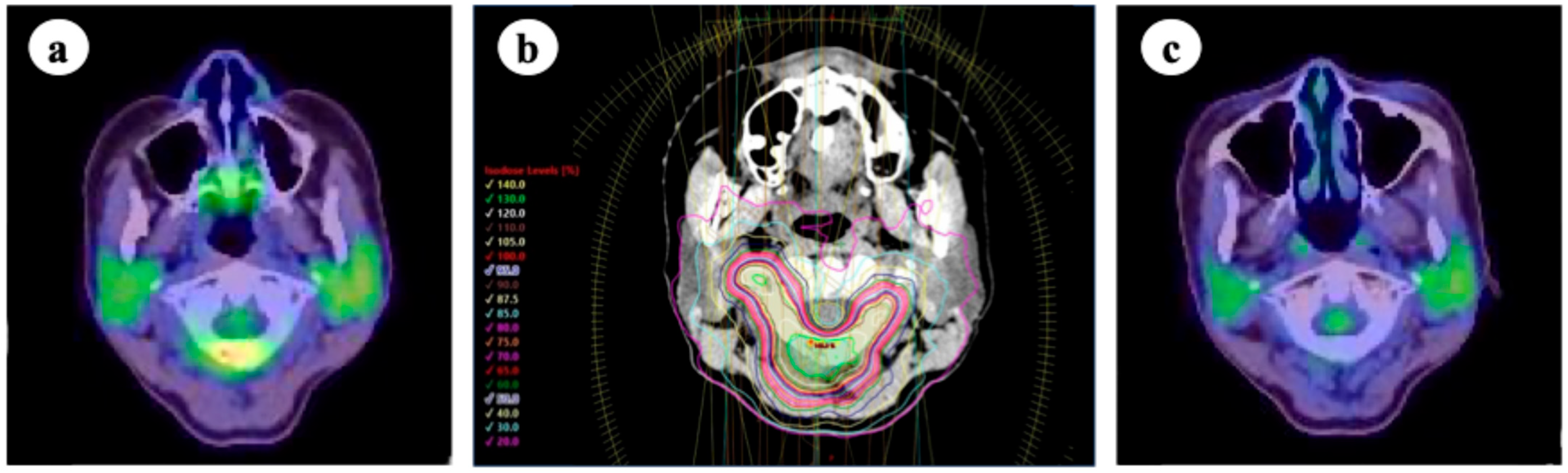 Cancers 17 02569 g003