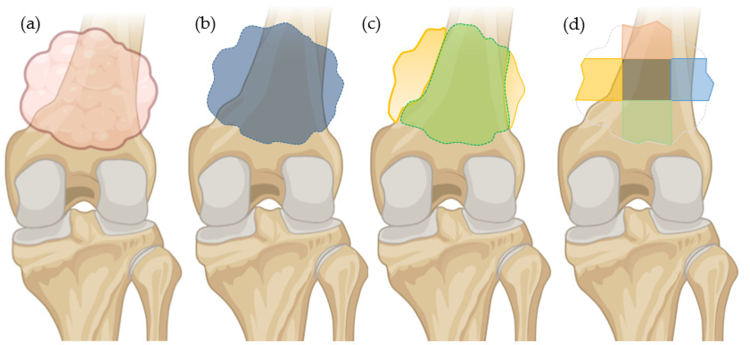 Cancers 17 02586 g003 Cancers 17 02586 g003