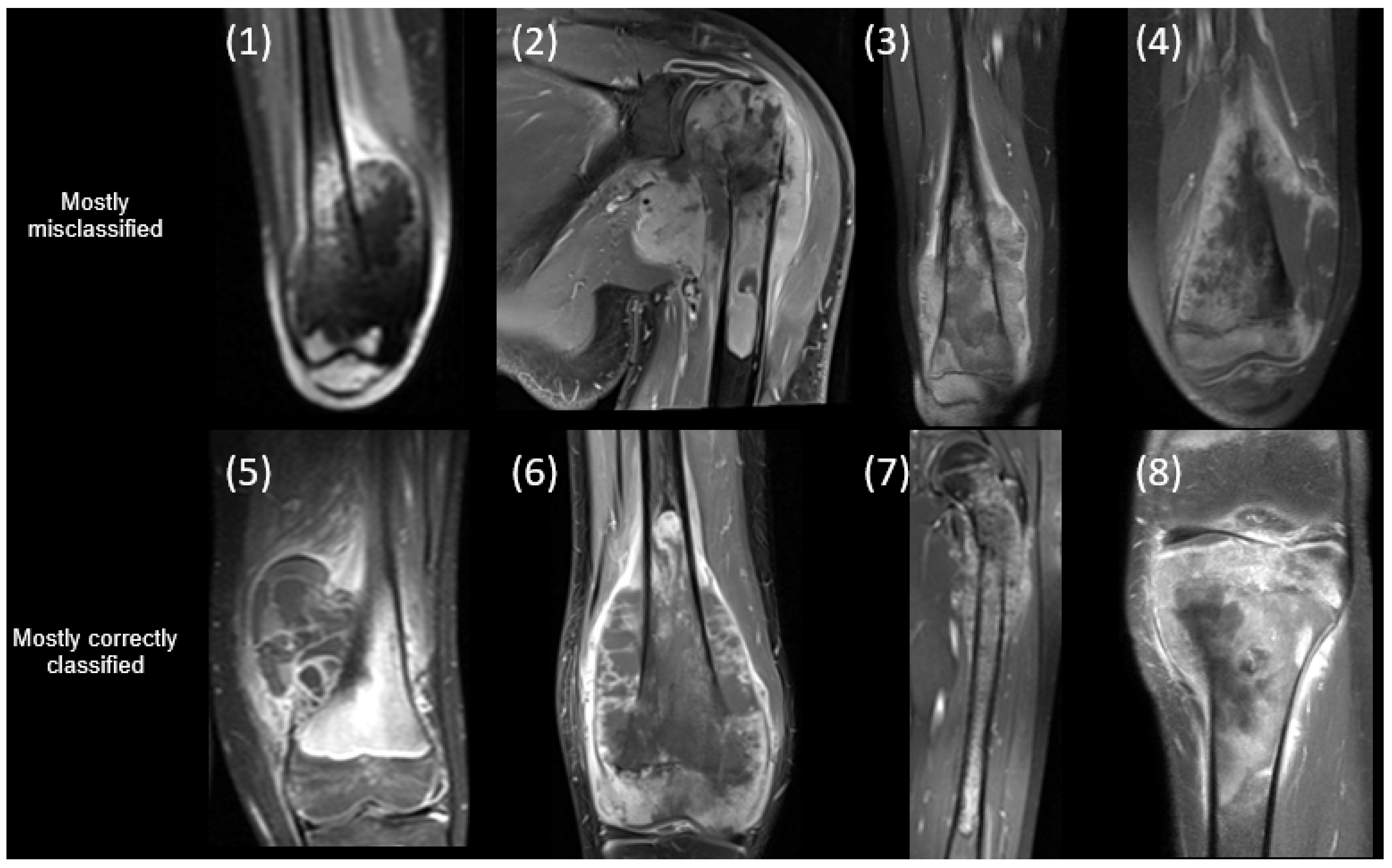 Cancers 17 02586 g004 Cancers 17 02586 g004