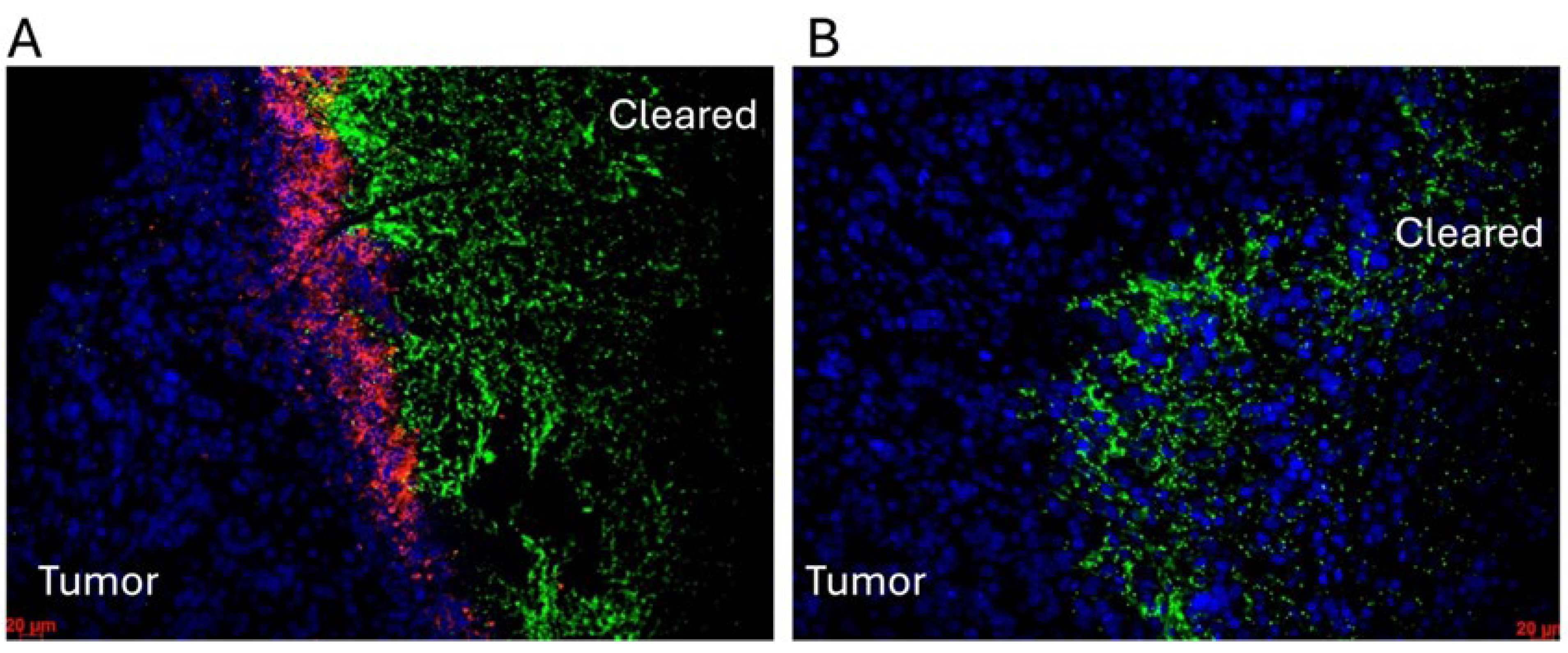 Cancers 17 02593 g003 Cancers 17 02593 g003