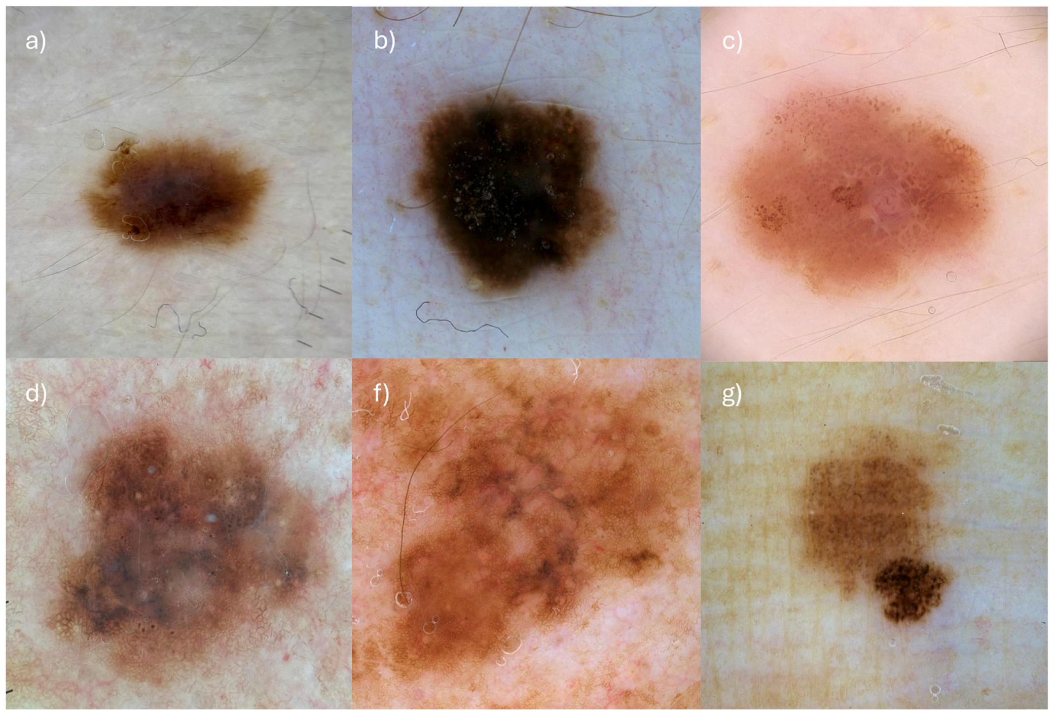 Cancers 17 02597 g003