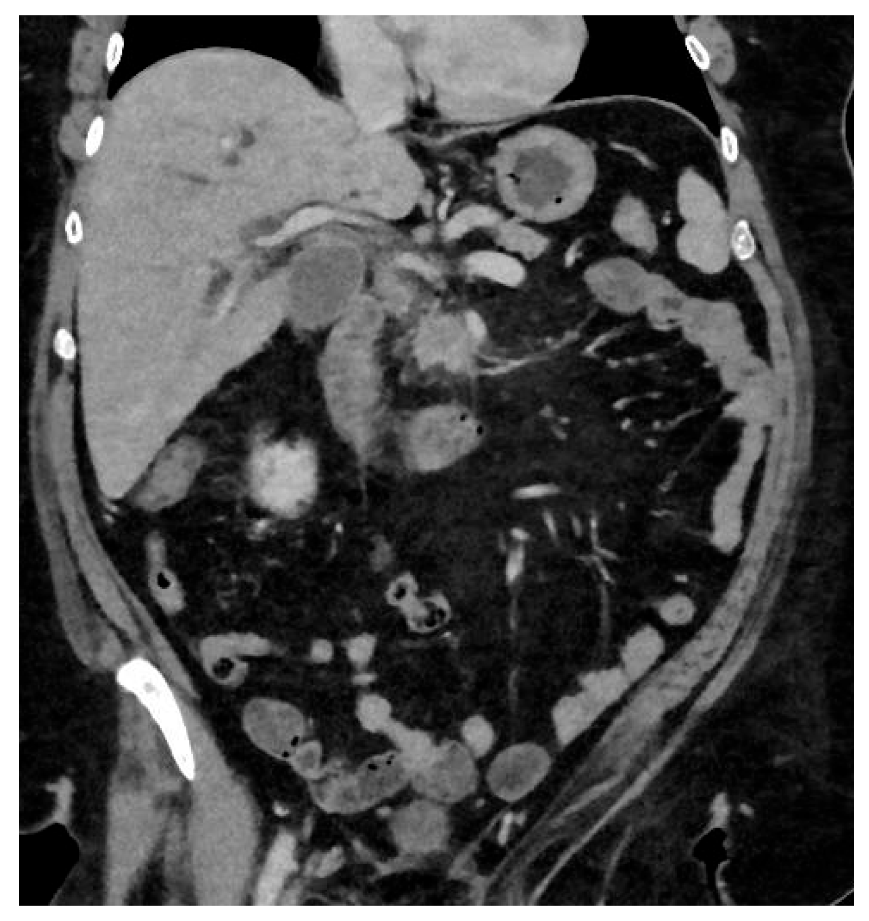 Cancers 17 02602 g002