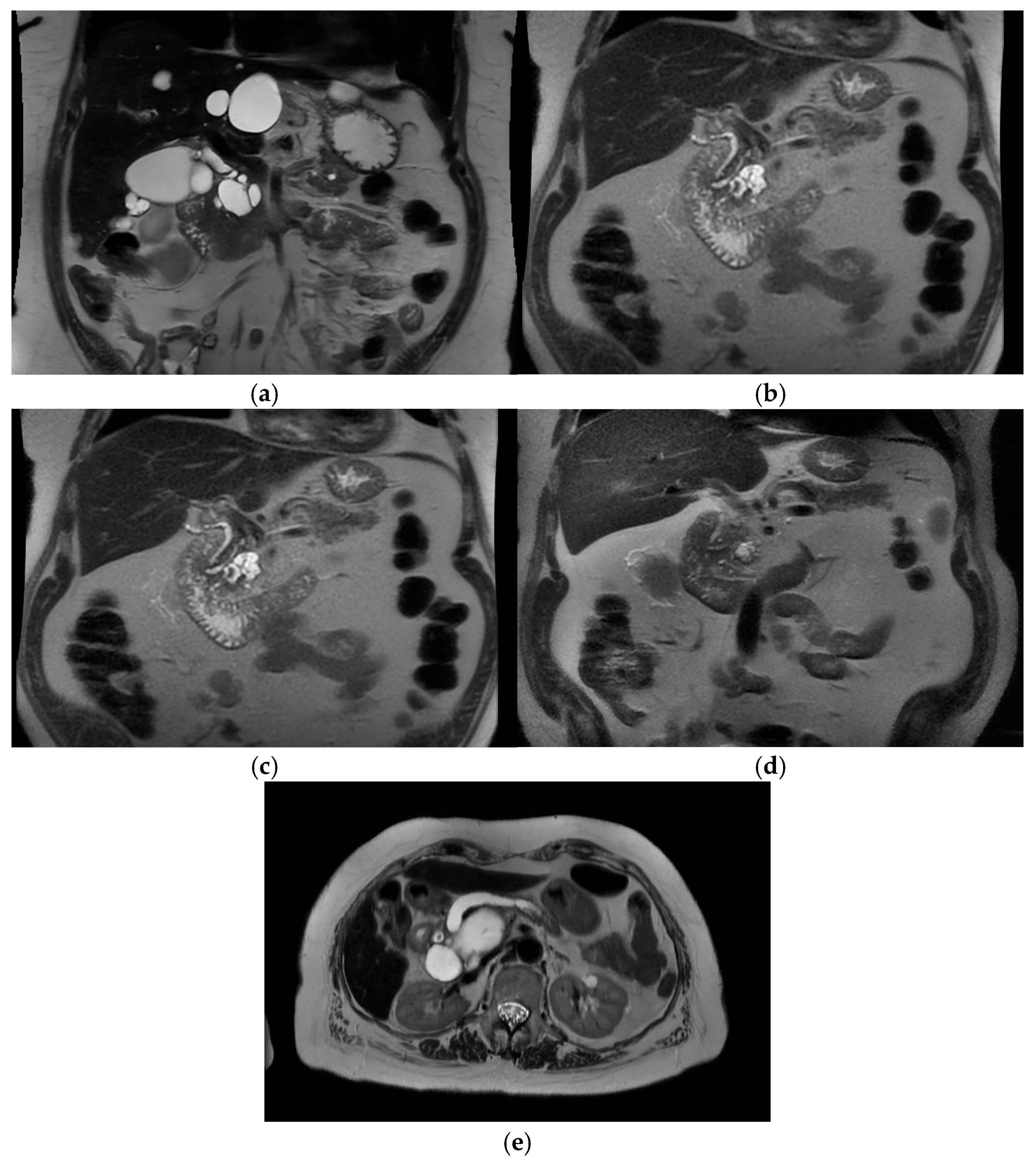 Cancers 17 02602 g003