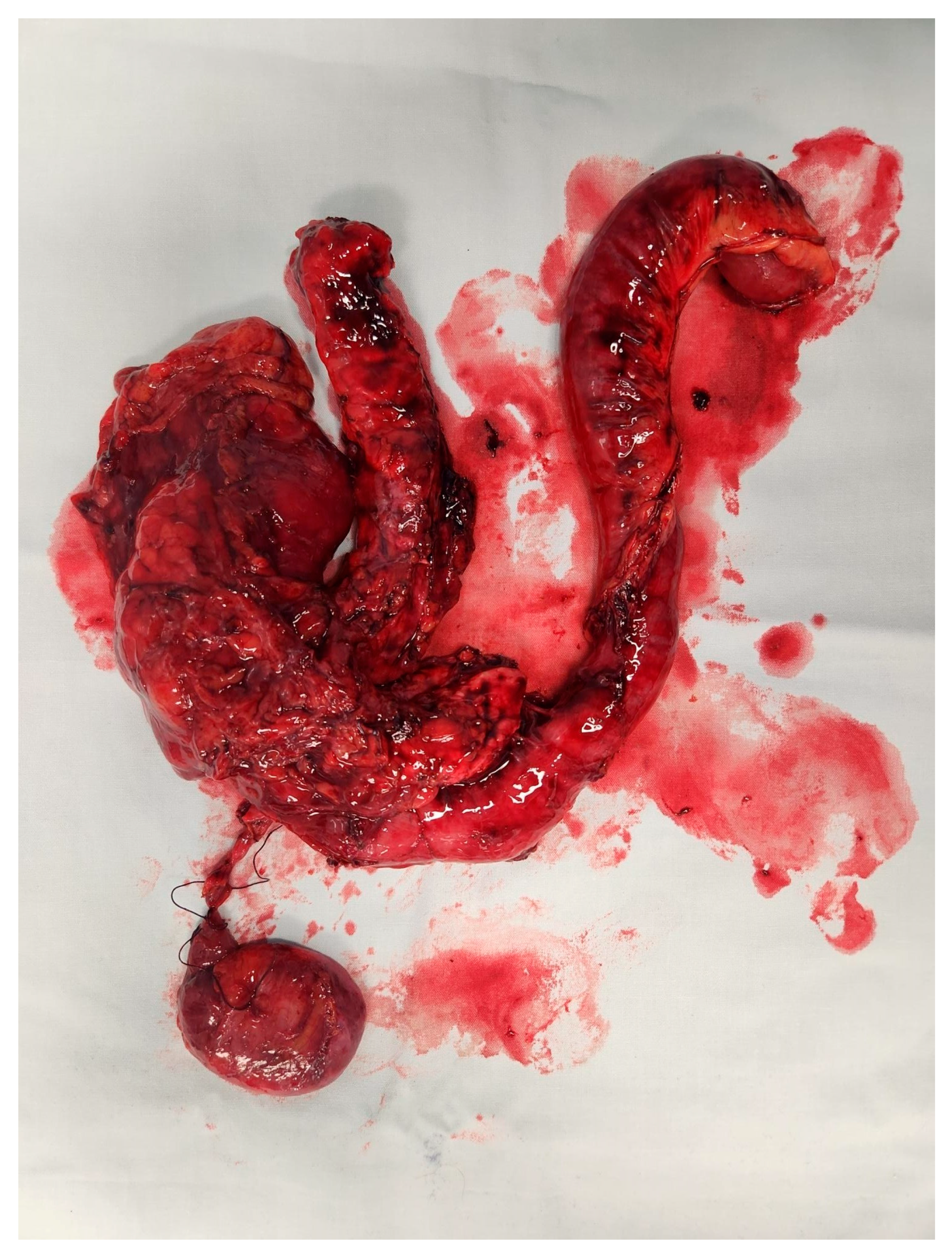 Cancers 17 02602 g004