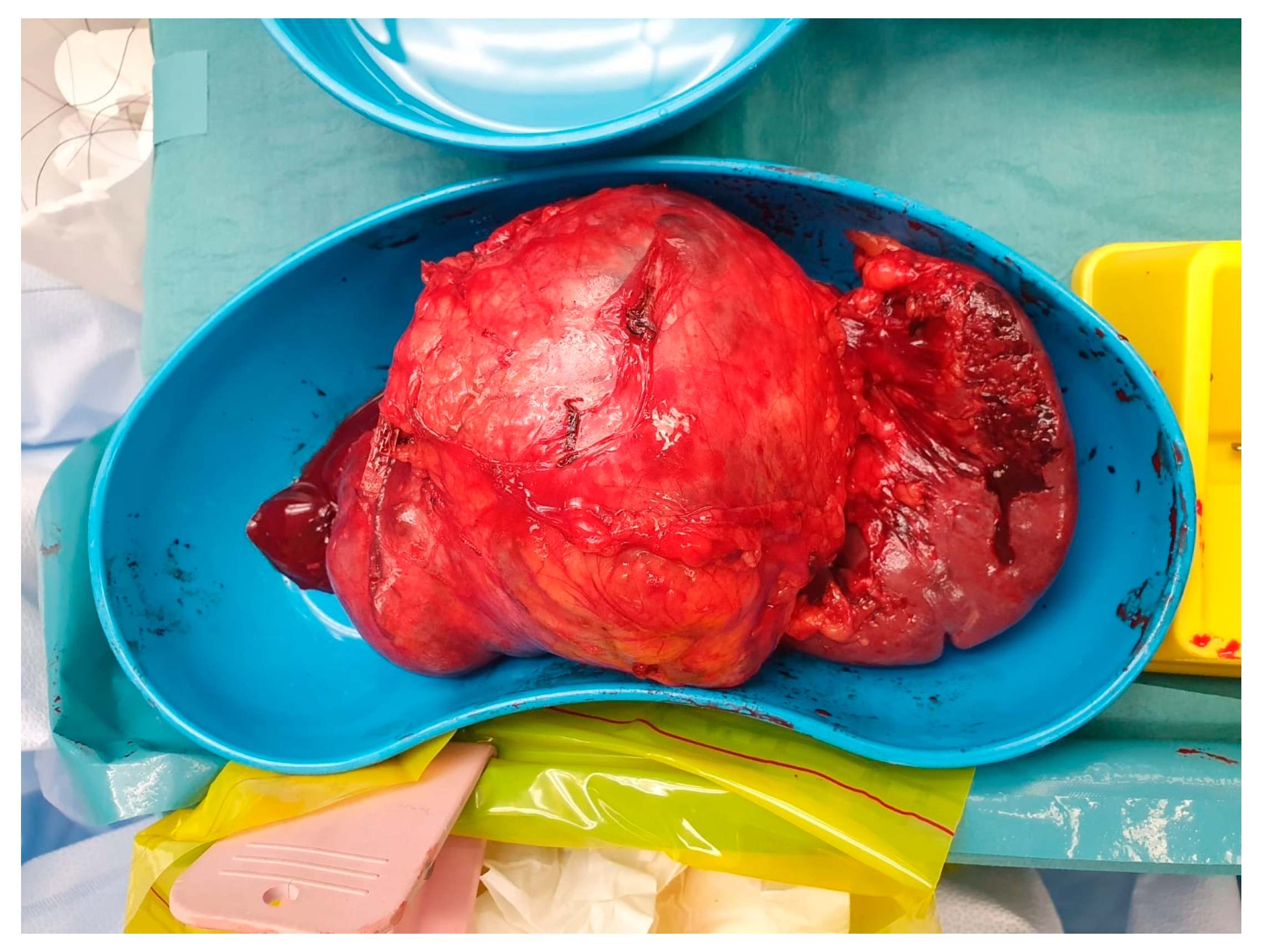 Cancers 17 02602 g005