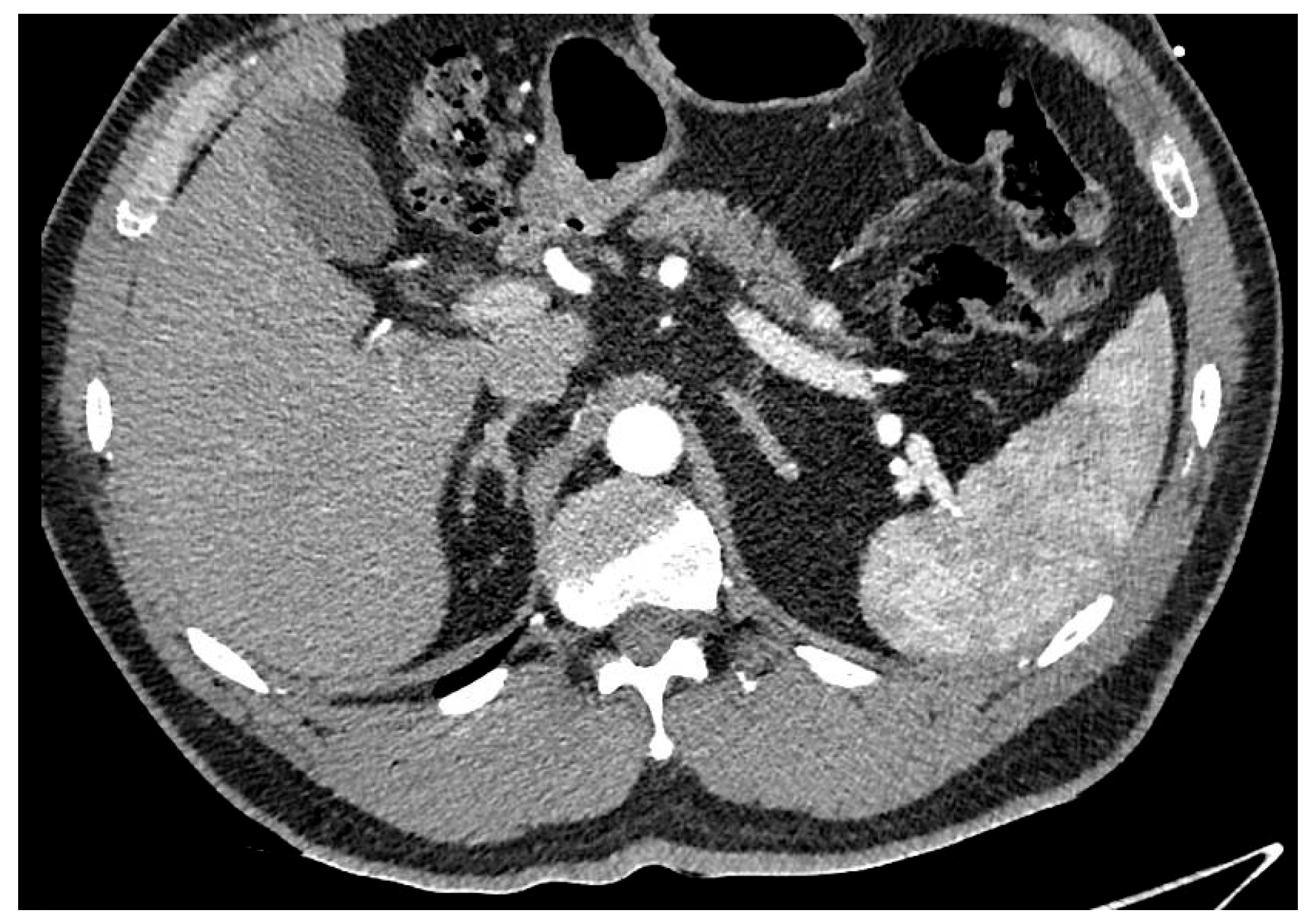 Cancers 17 02602 g006