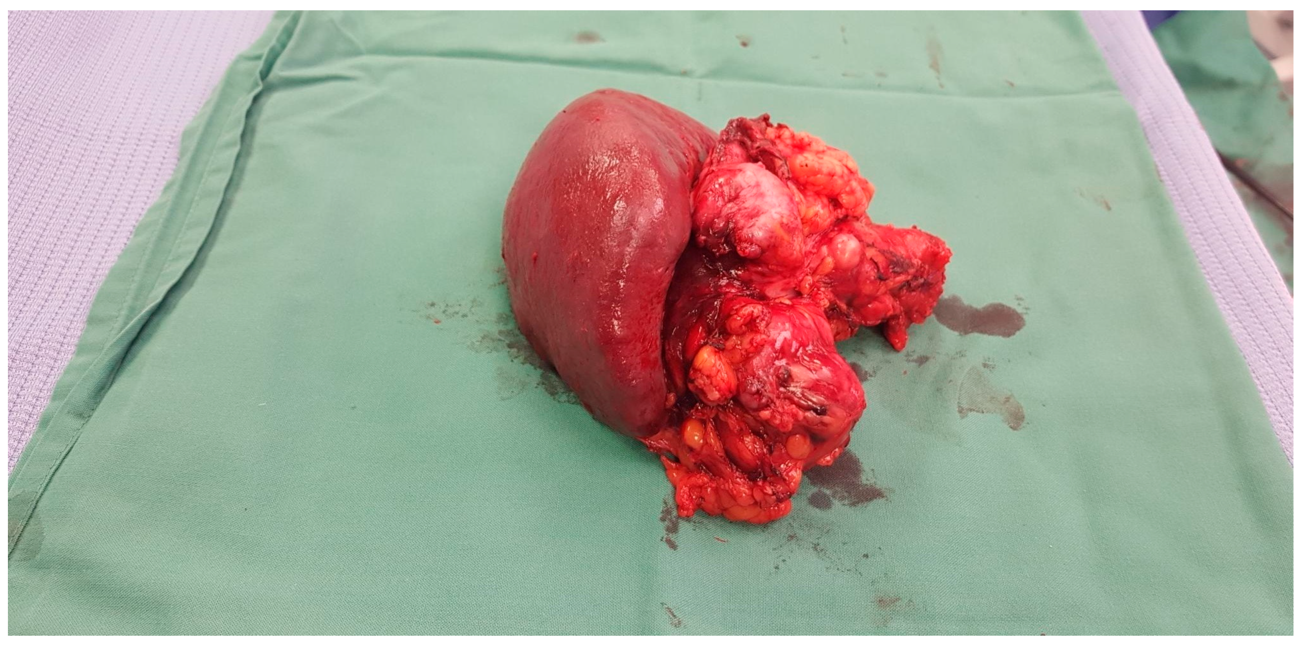 Cancers 17 02602 g007